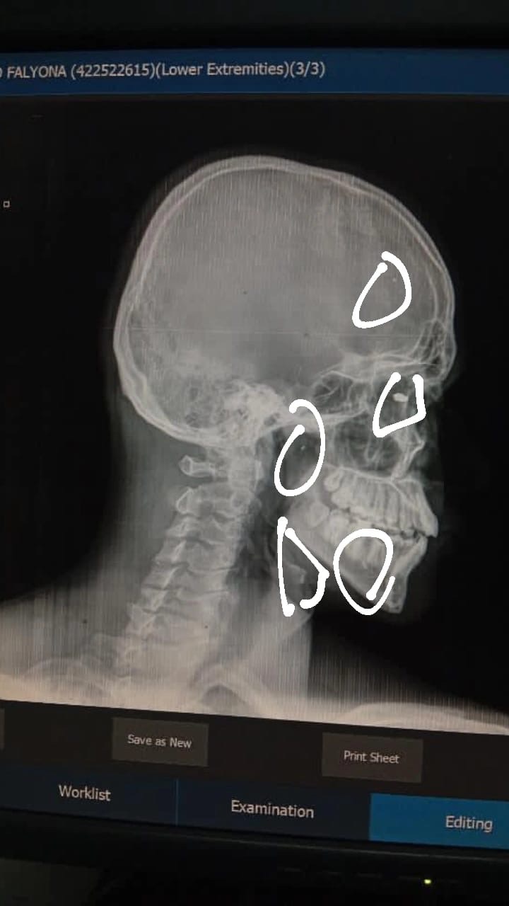 Help Mahmoud survive after devastating loss campaign photo, 2 of 8