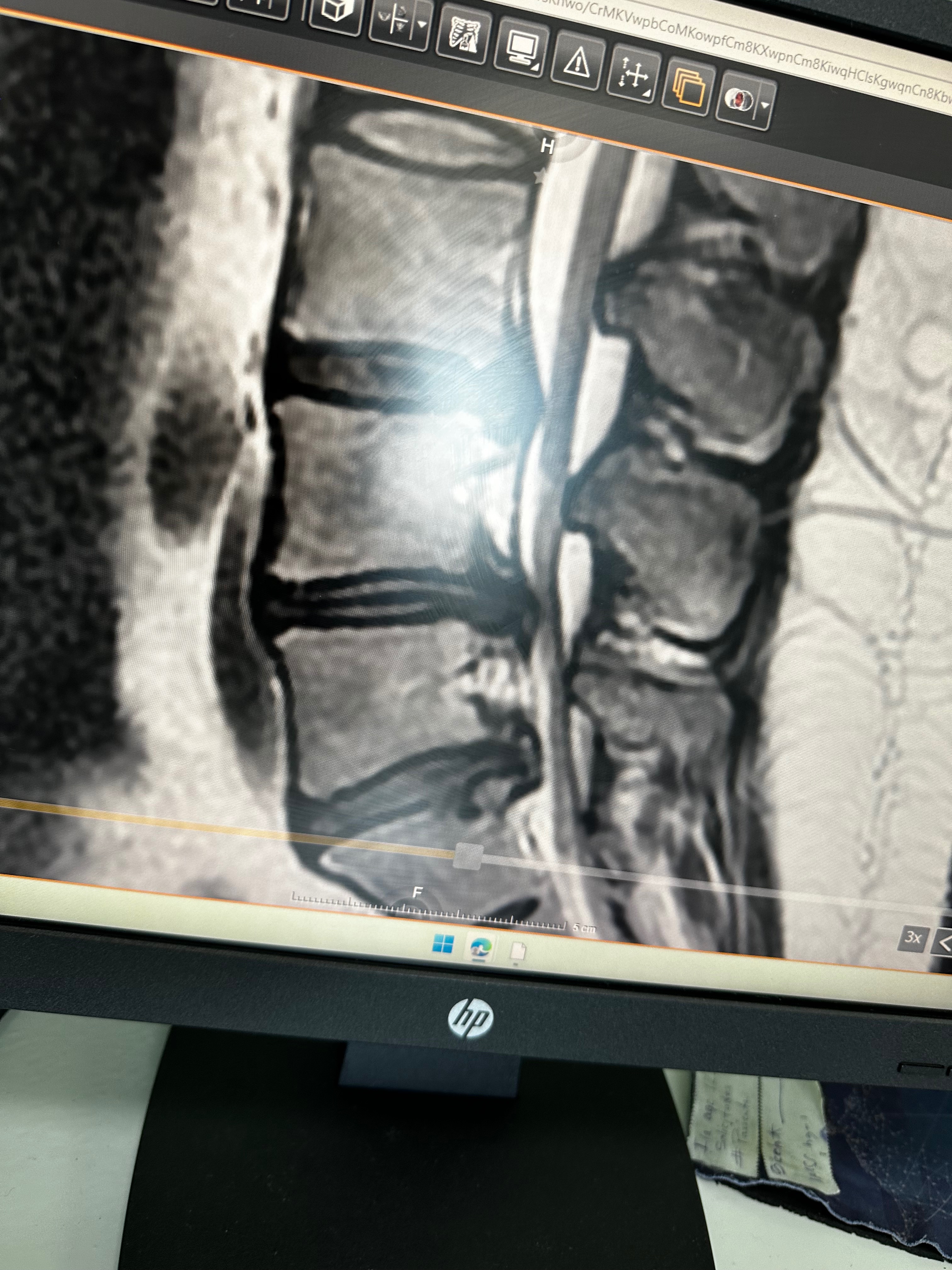 Recuperar movilidad de mis piernas campaign photo, 6 of 7