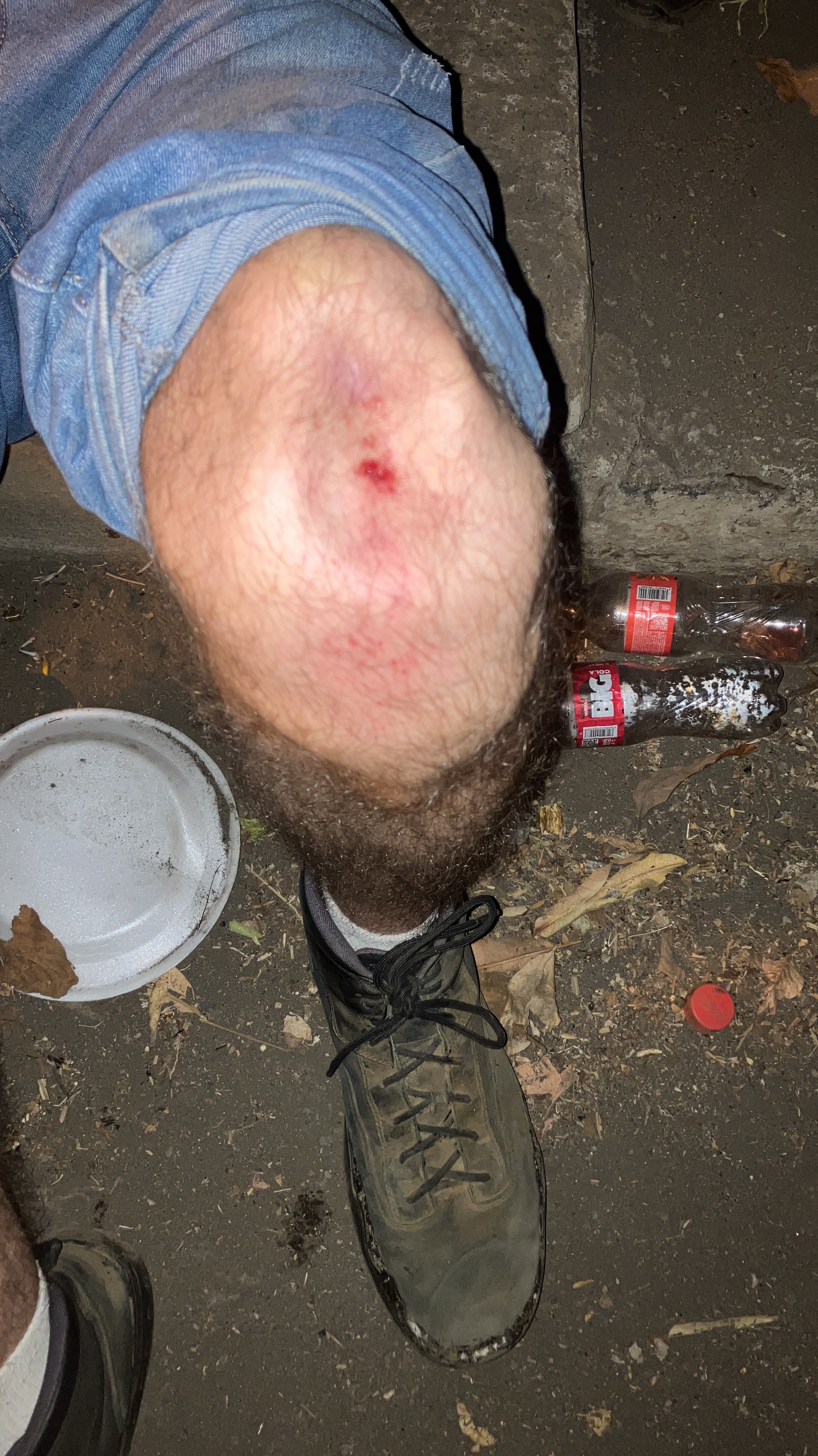 Fractured kneecap recovery… campaign photo, 2 of 8