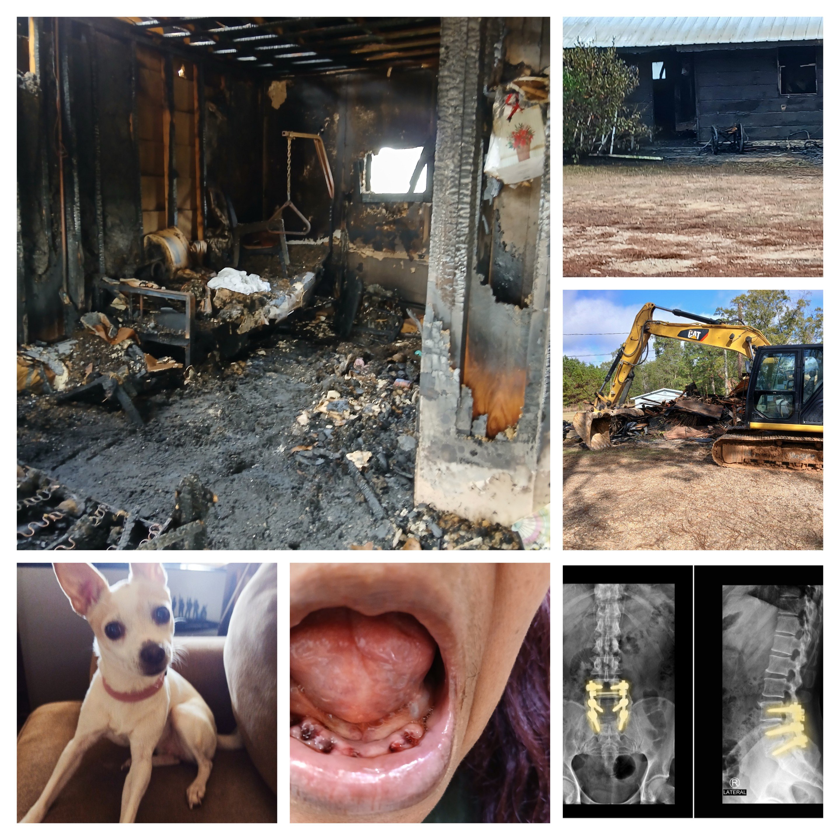Help Deirdre Rebuild After Fire & Health Struggles campaign photo, 2 of 8