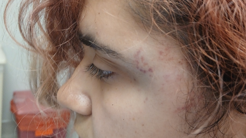 Justice and Healing for My Fiance's Recovery photo