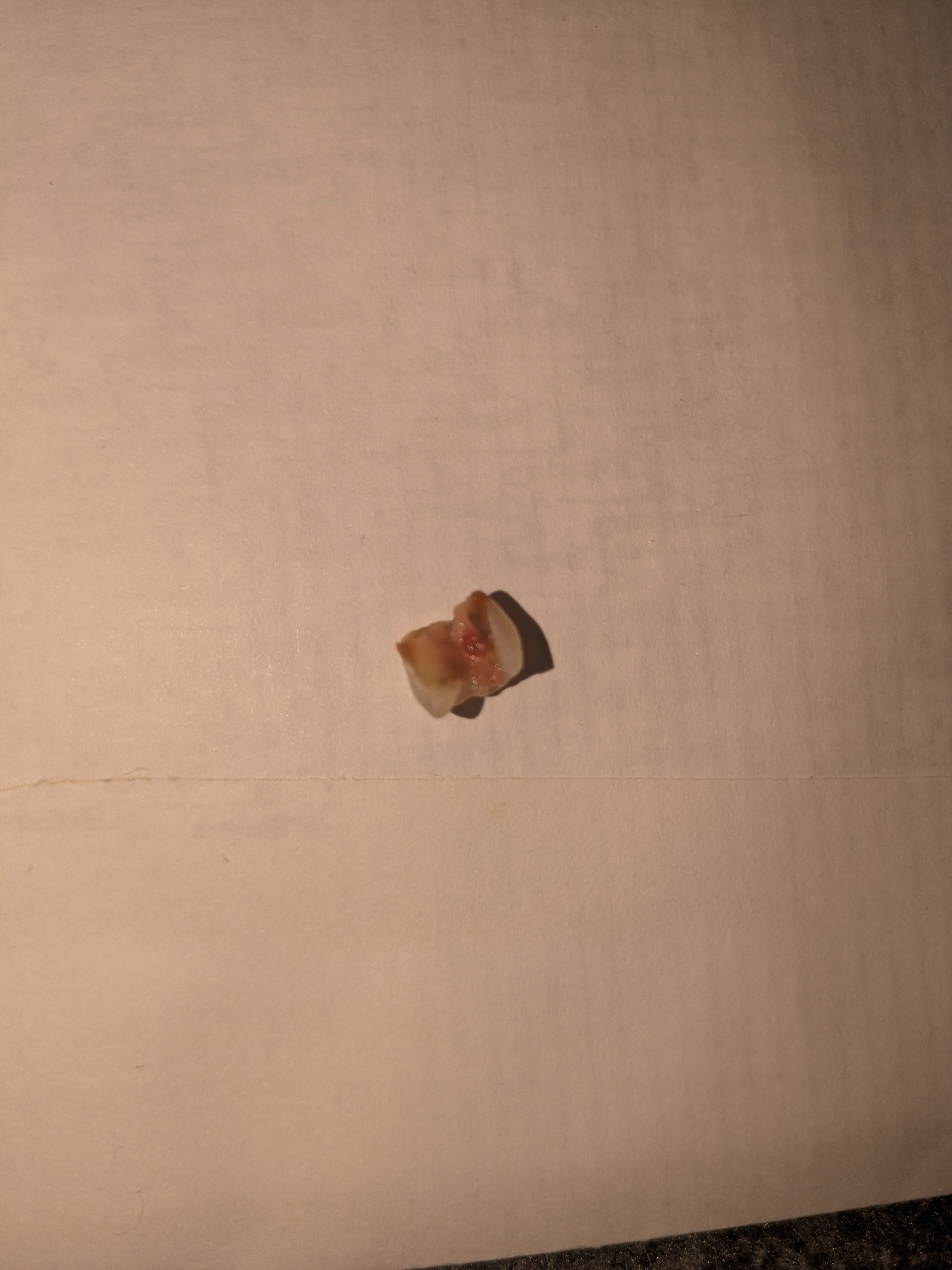 Help Me Smile Again — Dental Reconstruction at 46 campaign photo, 2 of 7