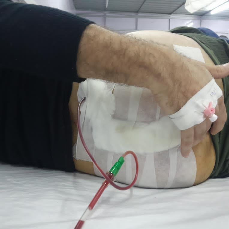 Please Donate to Help Youssef, in Gaza, with Medical Costs campaign photo, 6 of 7