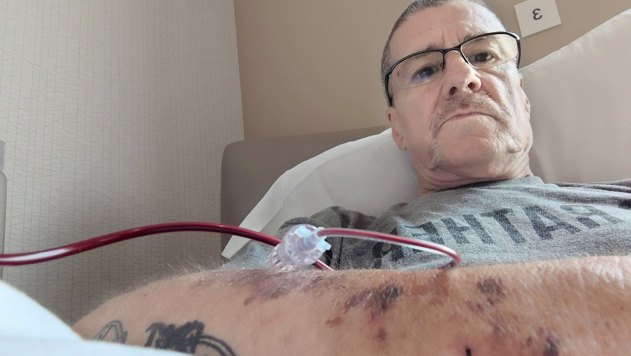 Support for James Salyer’s Leukemia Battle photo