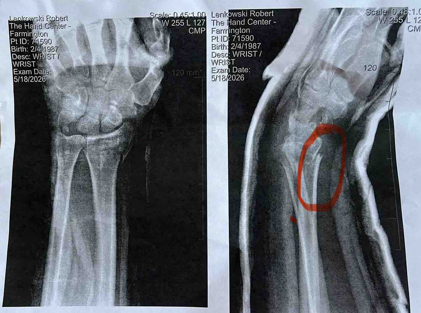 Support Robert’s Surgery for a Violinist’s Recovery campaign photo, 2 of 8