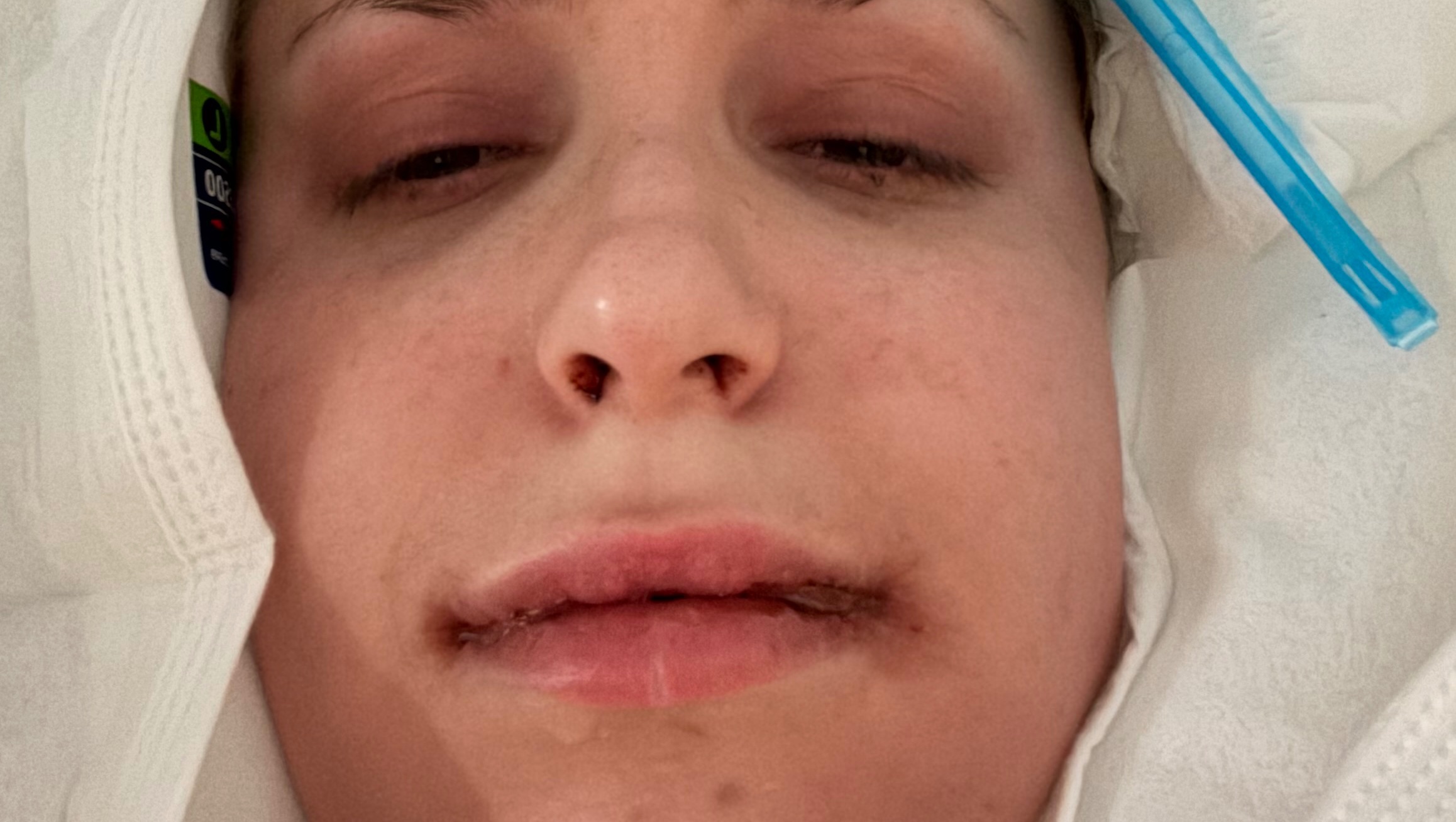 Please help me cover my surgery cost and post op care photo