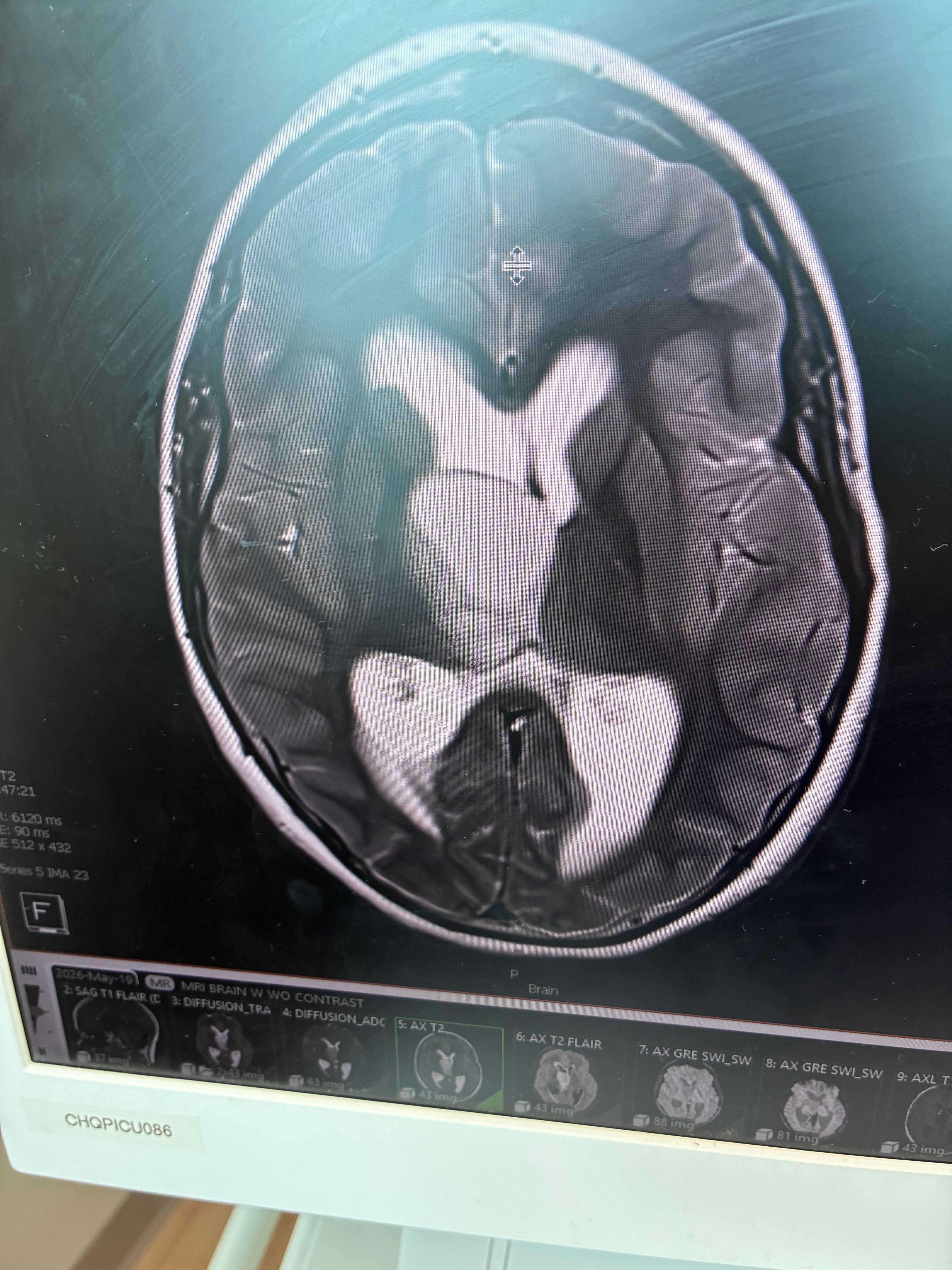 Support for Athena’s Terminal Brain Tumor Care campaign photo, 6 of 7