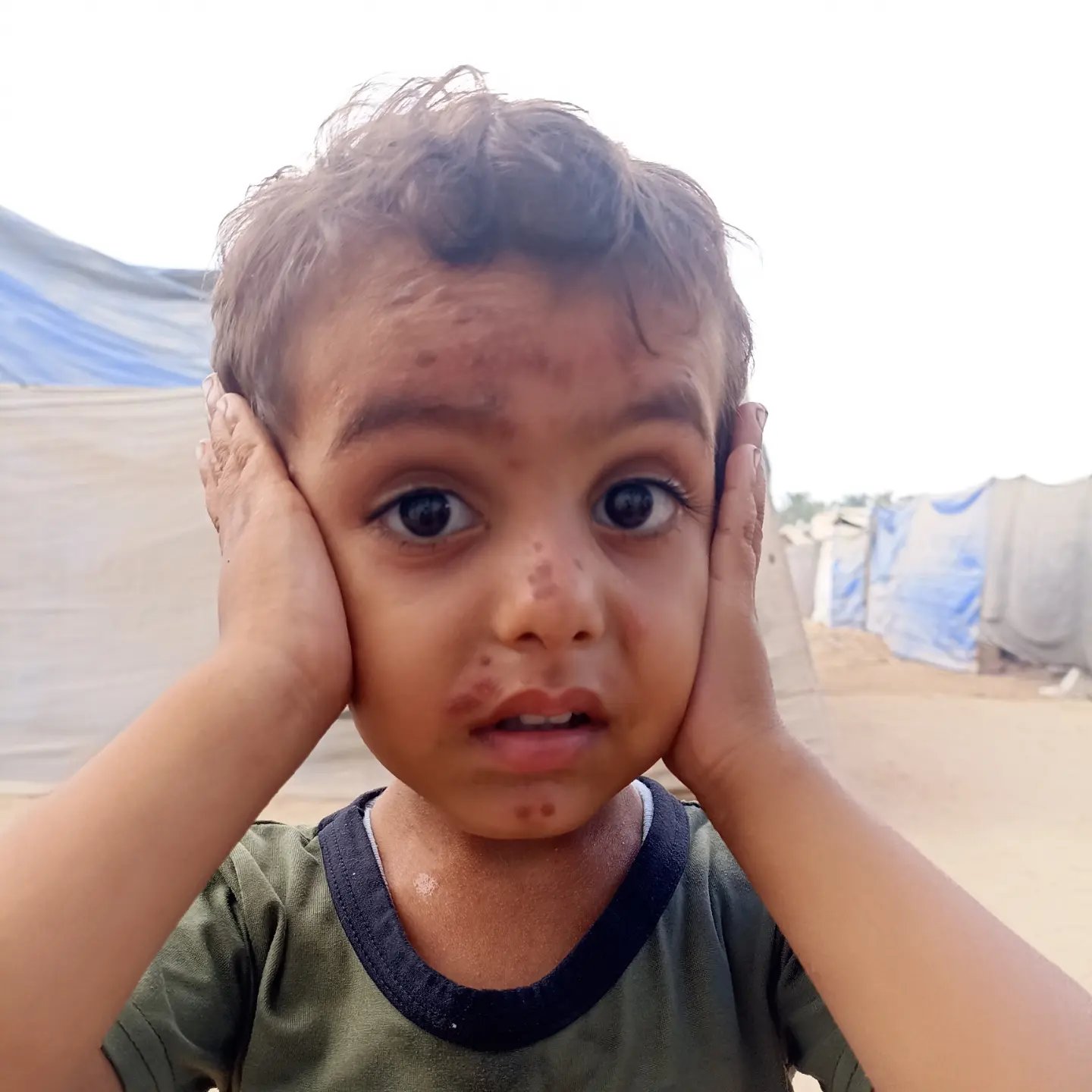 Save Baby Qais — Urgent Medical Evacuation From Gaza campaign photo, 5 of 6
