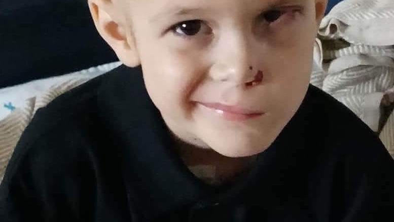 Support Alex's Fight Against a Brain Tumor photo