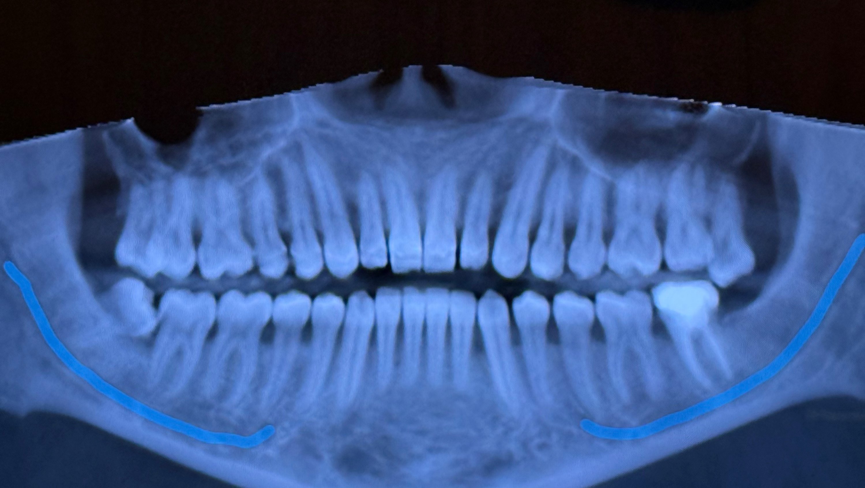 Help Kami Get Urgent Dental Care photo