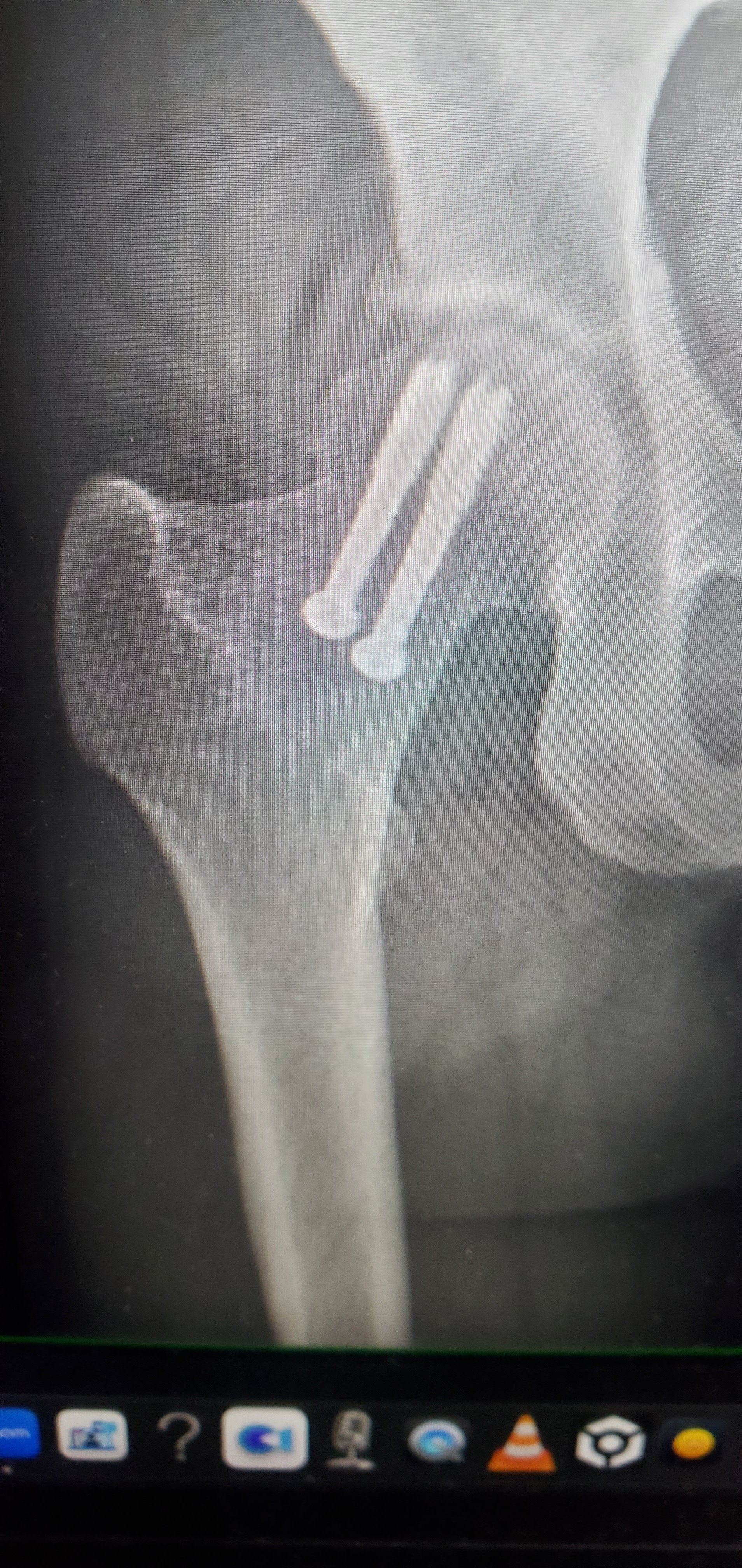 Help Morgan Heal with a New Hip campaign photo, 6 of 7