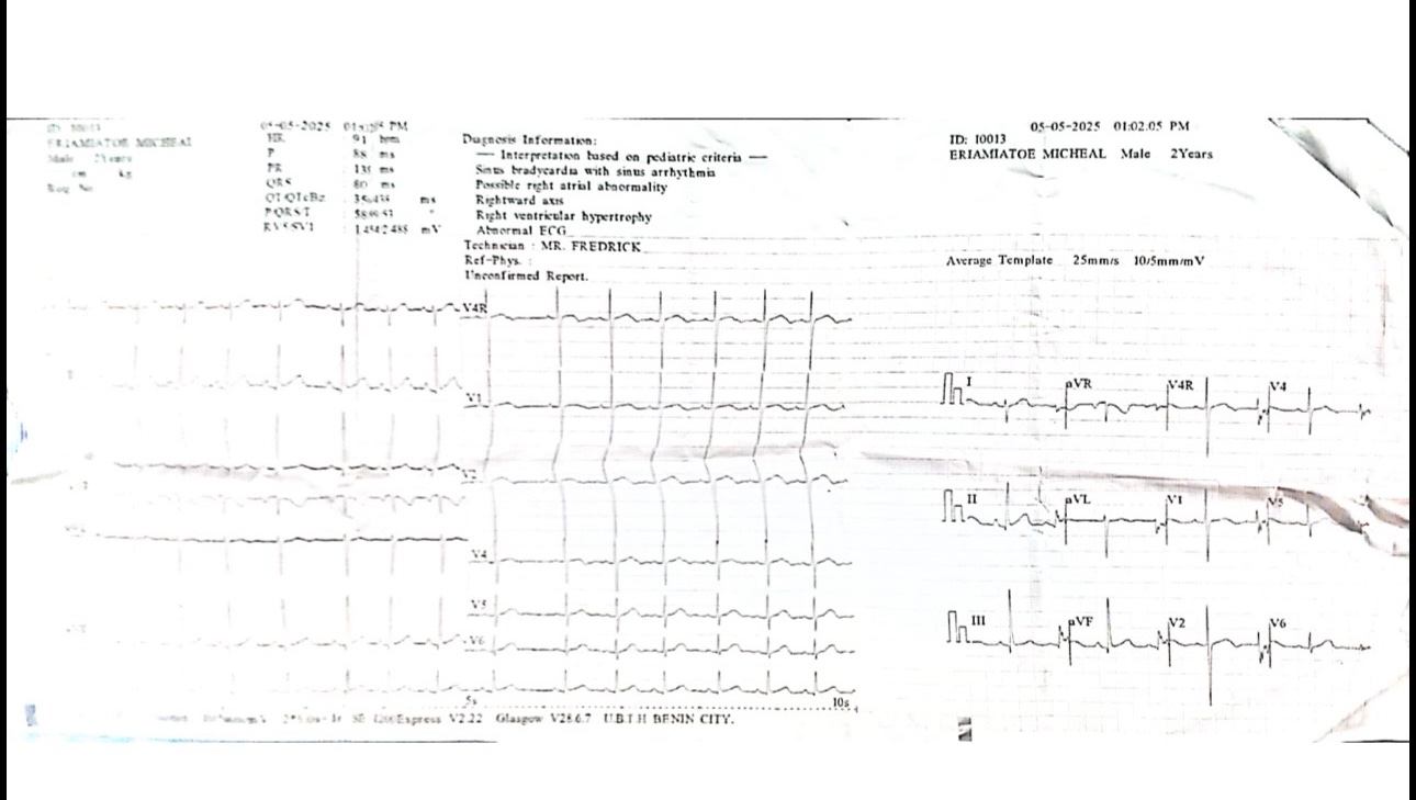Save 4-Year-Old Michael’s Life — Urgent Heart Surgery Needed photo