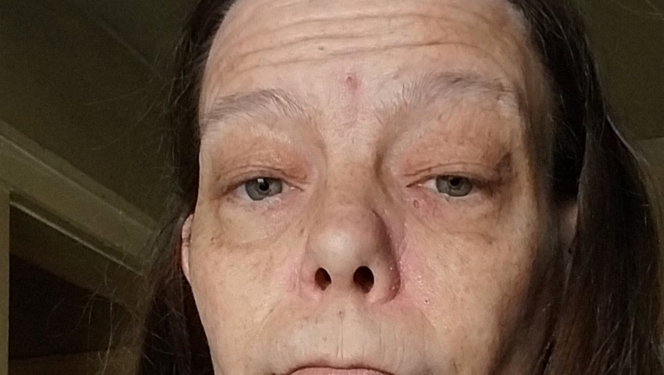 Help Shonda get the Medical Treatment Needed photo