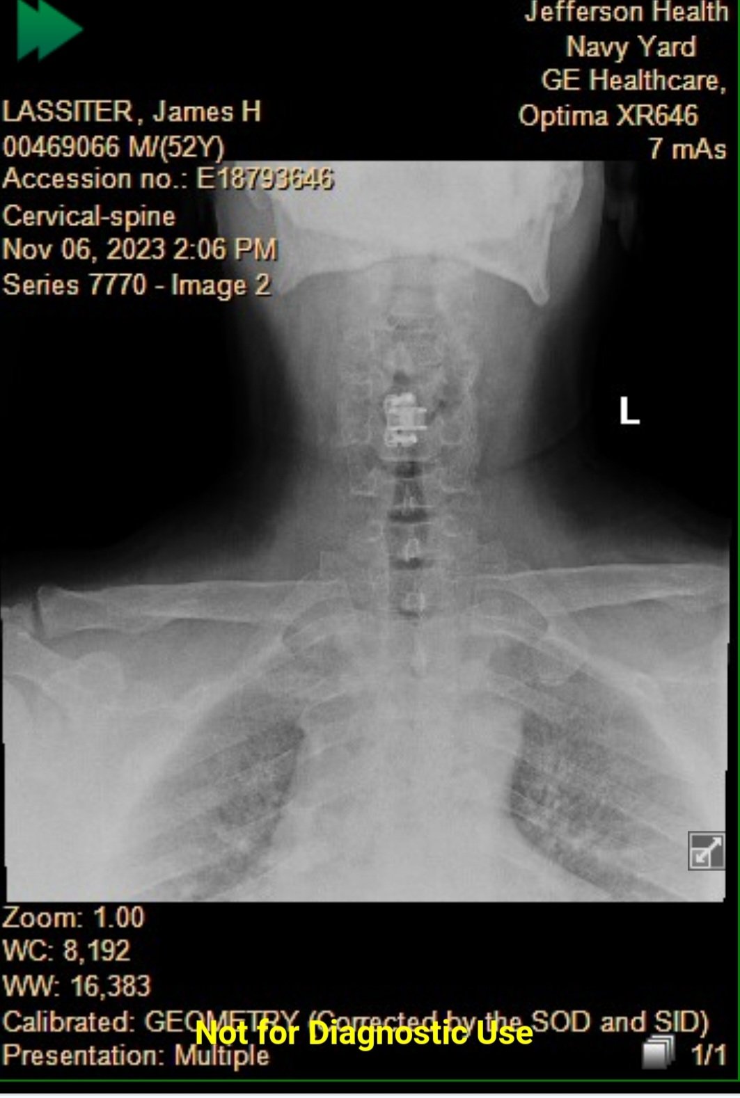 Fundraiser by James Lassiter : Help Me Rebuild Life After a Spinal Cord ...