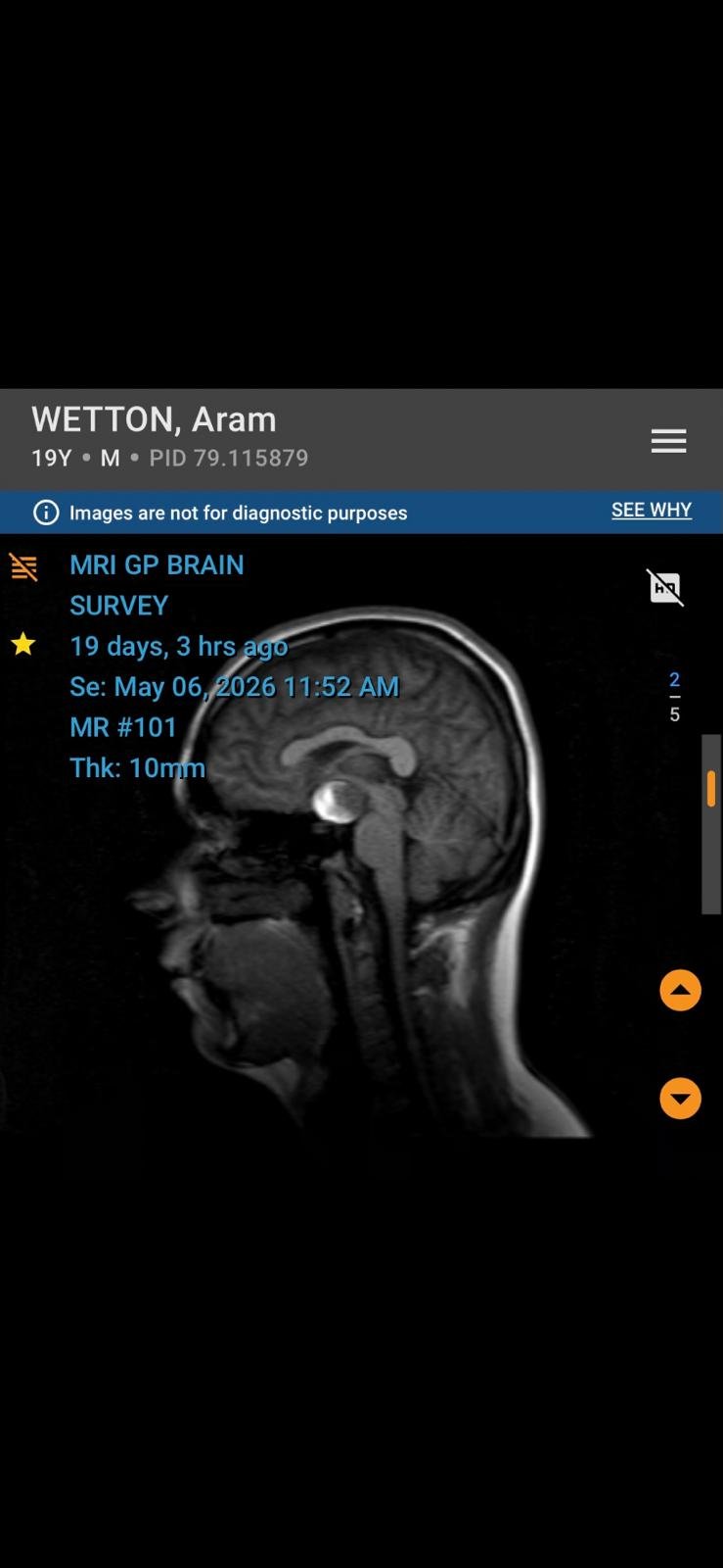 Help Aram Fight Back After a Massive Brain Aneurysm campaign photo, 2 of 7