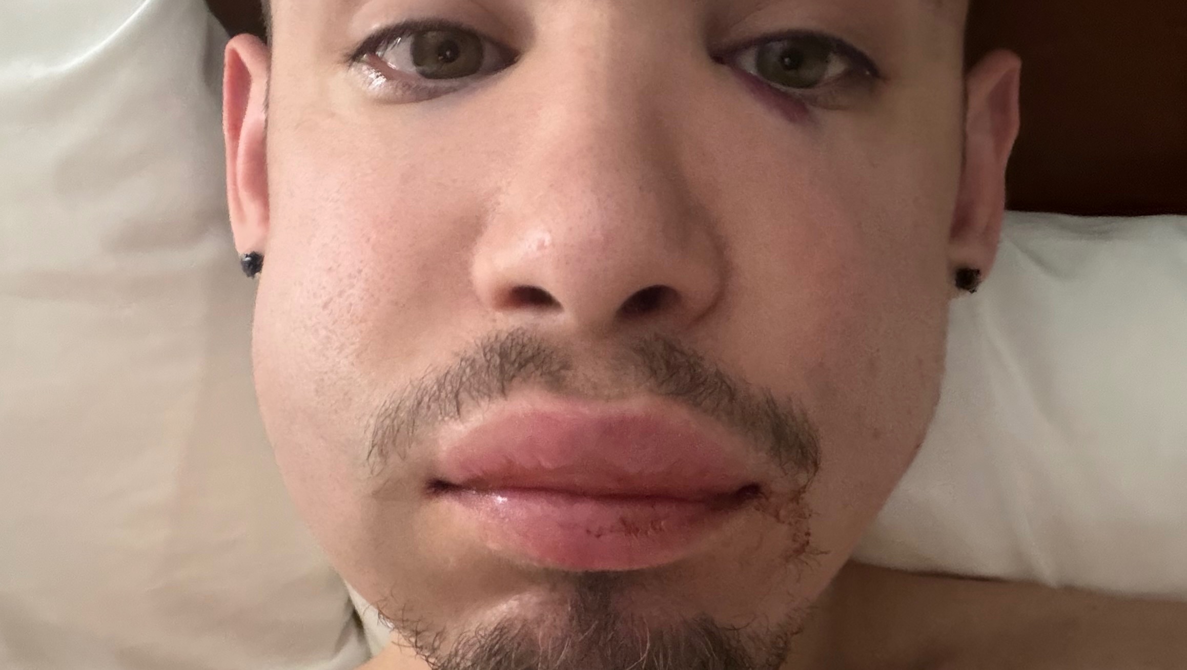 Help Alec Recover and Stay Safe photo