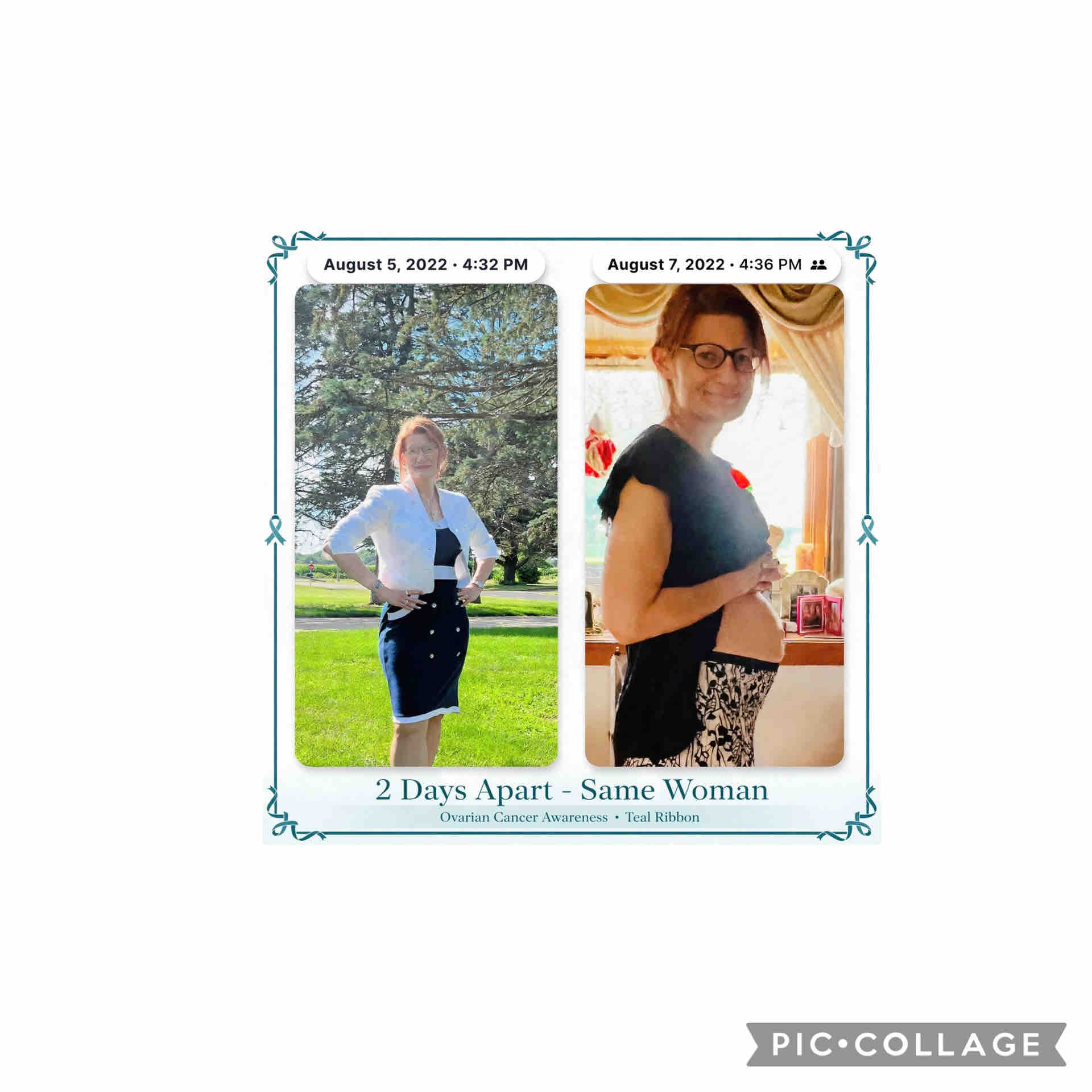 HELP SUPPORT TEAL-Ovarian Cancer Early Signs-SAVE LIVES campaign photo, 8 of 11