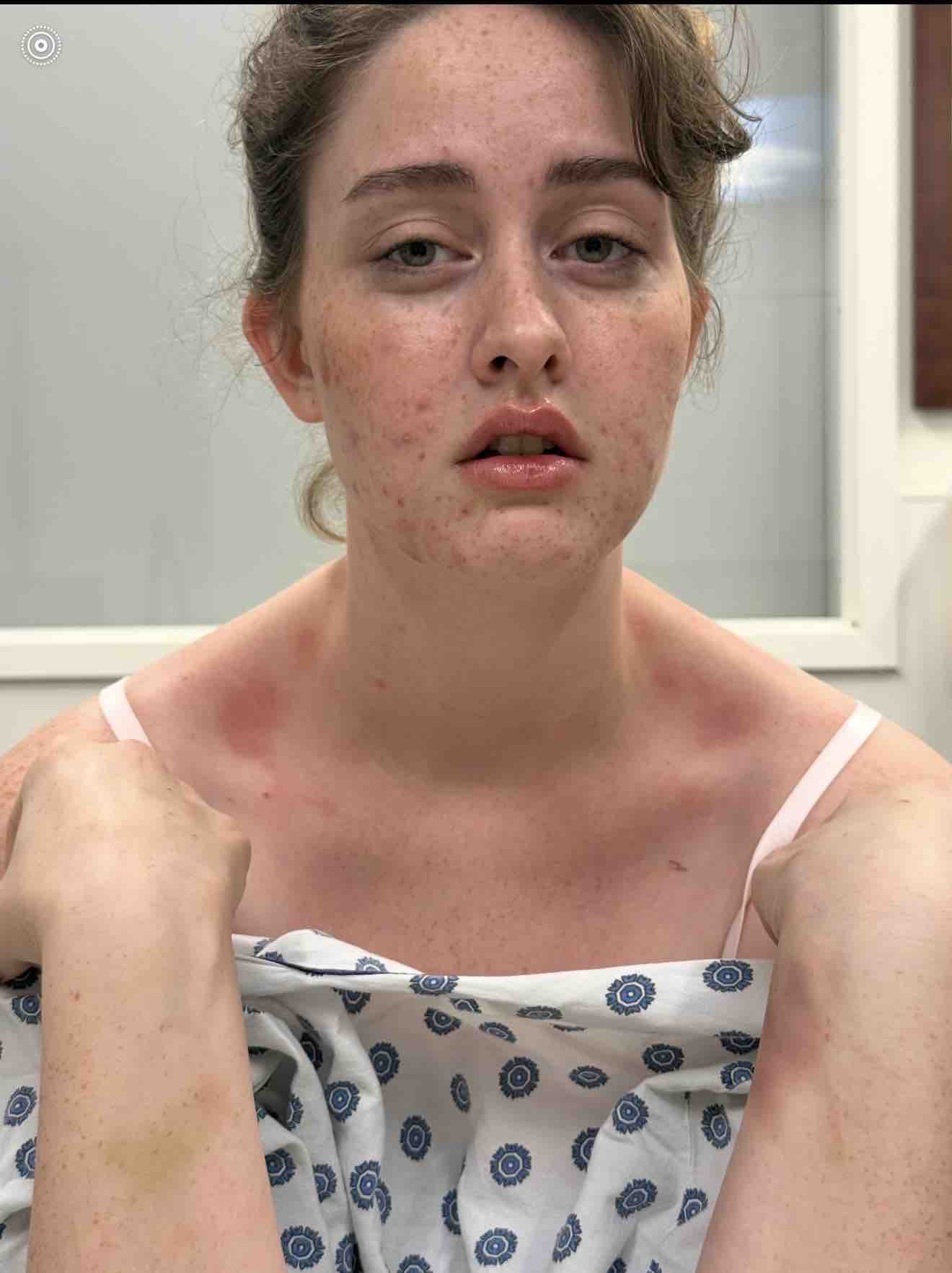 Help Olivia Survive Rare Neurological Disease campaign photo, 12 of 13