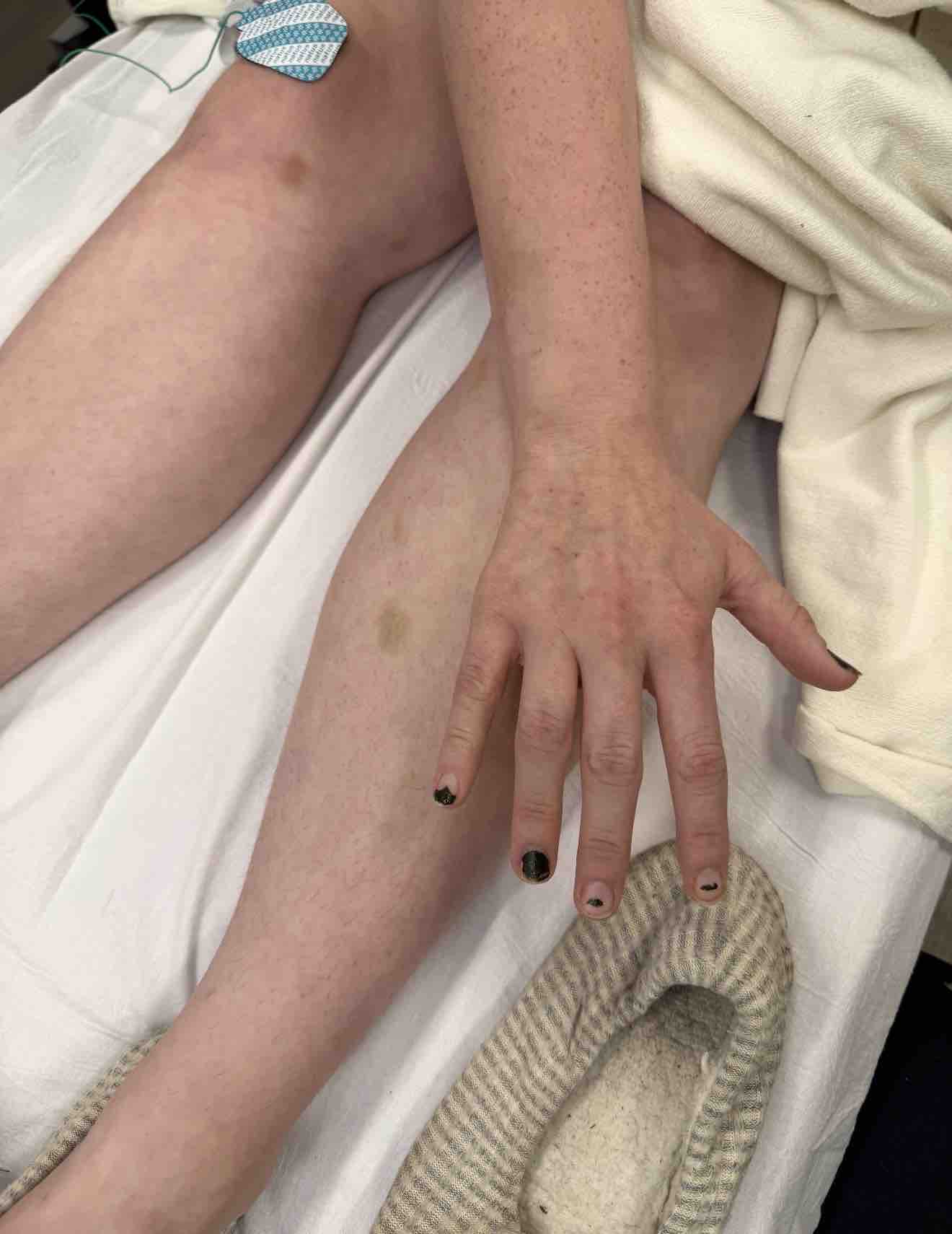 Help Olivia Survive Rare Neurological Disease campaign photo, 2 of 13
