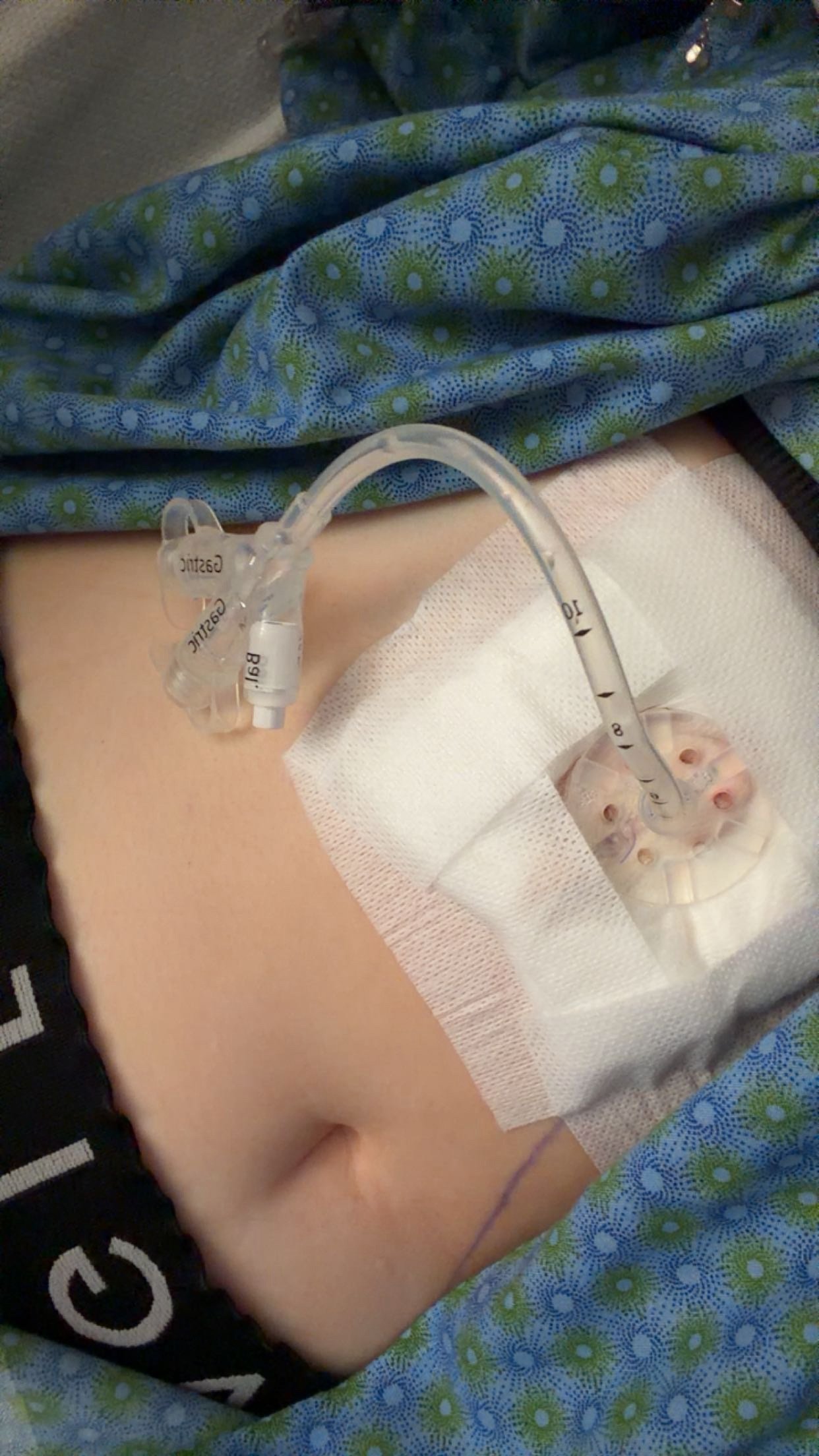 Help Kenzee Through Major Surgery, ICU Stay, and Recovery campaign photo, 2 of 8