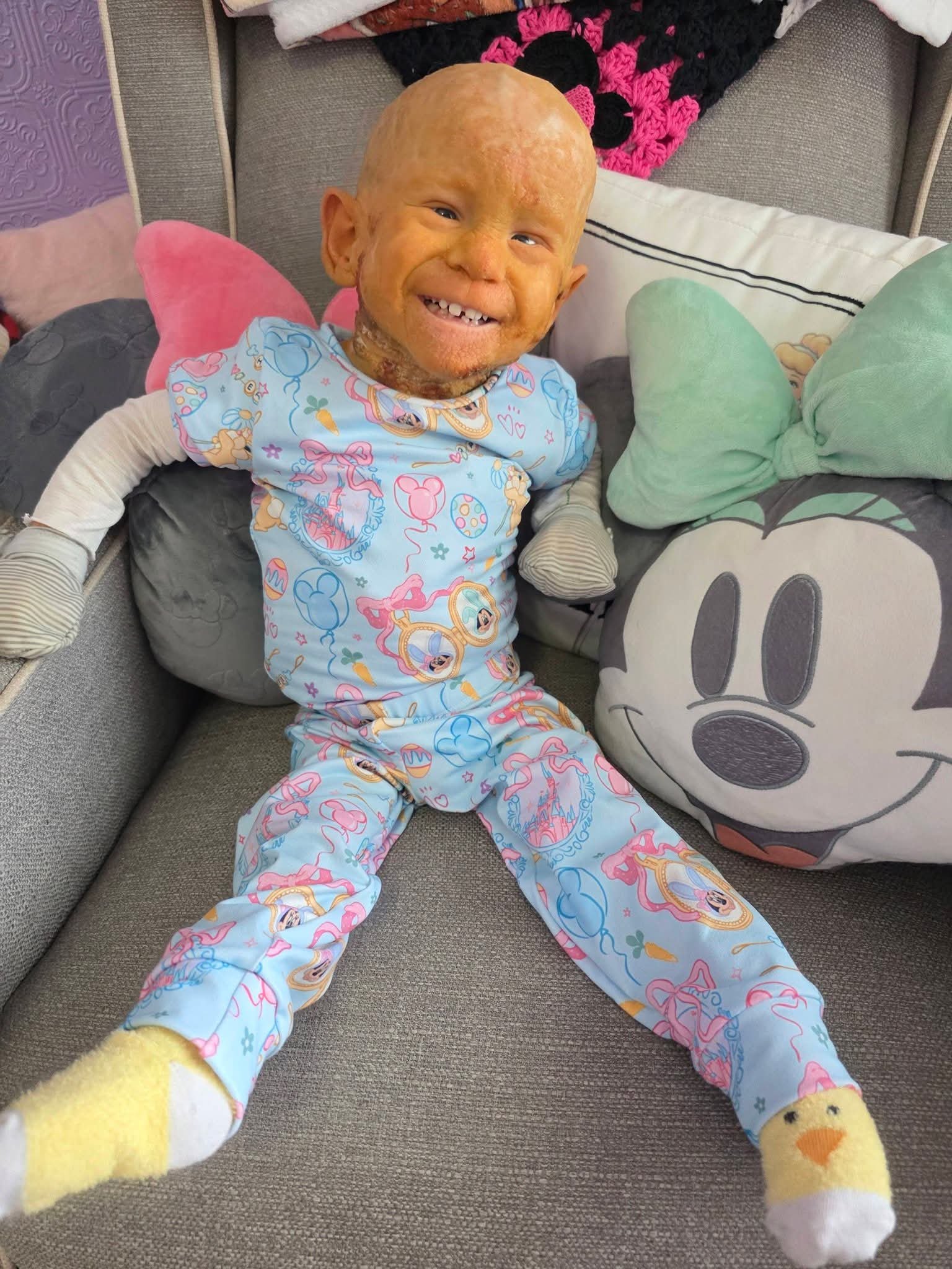 Help Scarlett Defy the Odds with KID Syndrome campaign photo, 7 of 8