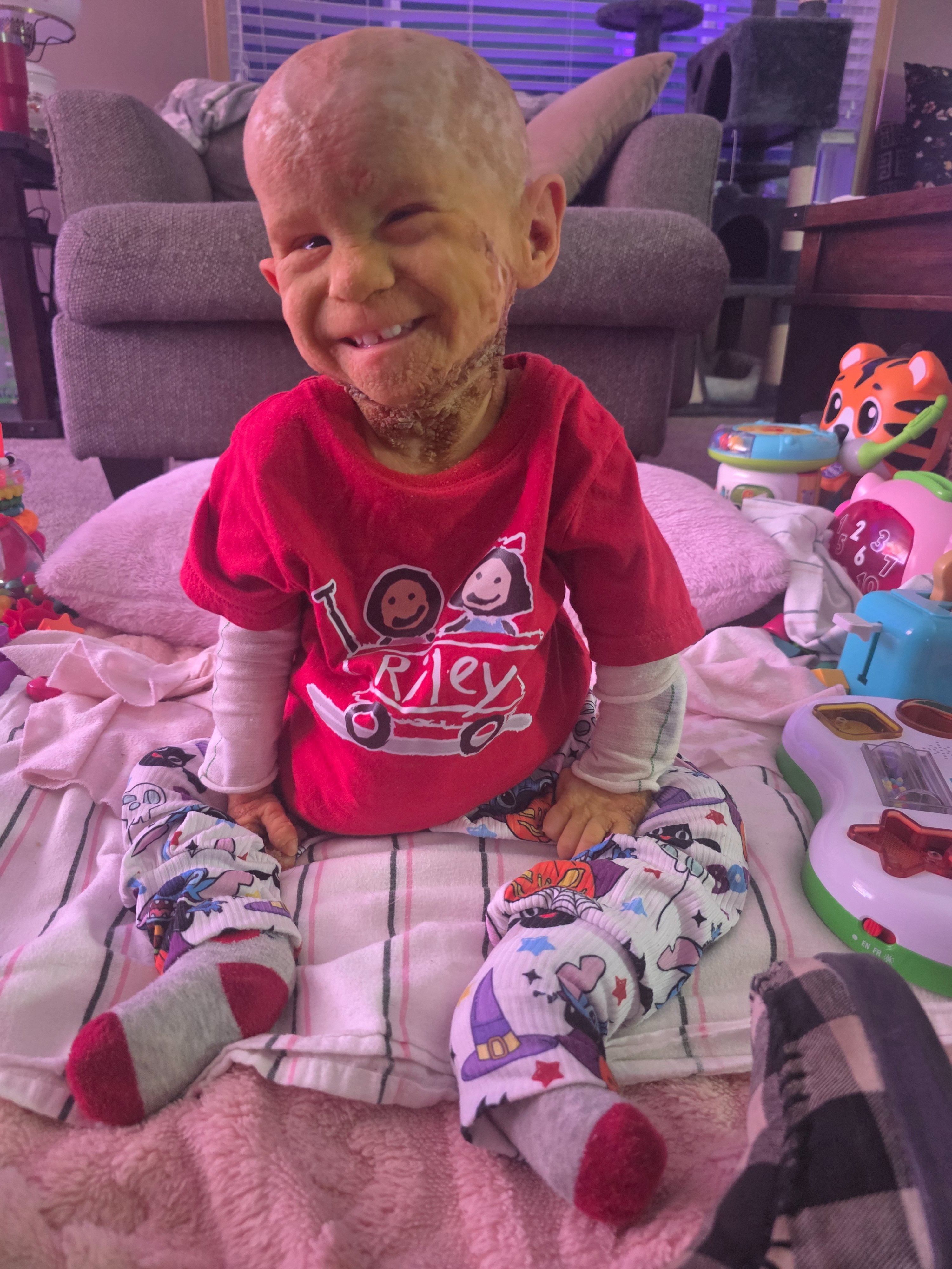 Help Scarlett Defy the Odds with KID Syndrome campaign photo, 2 of 8