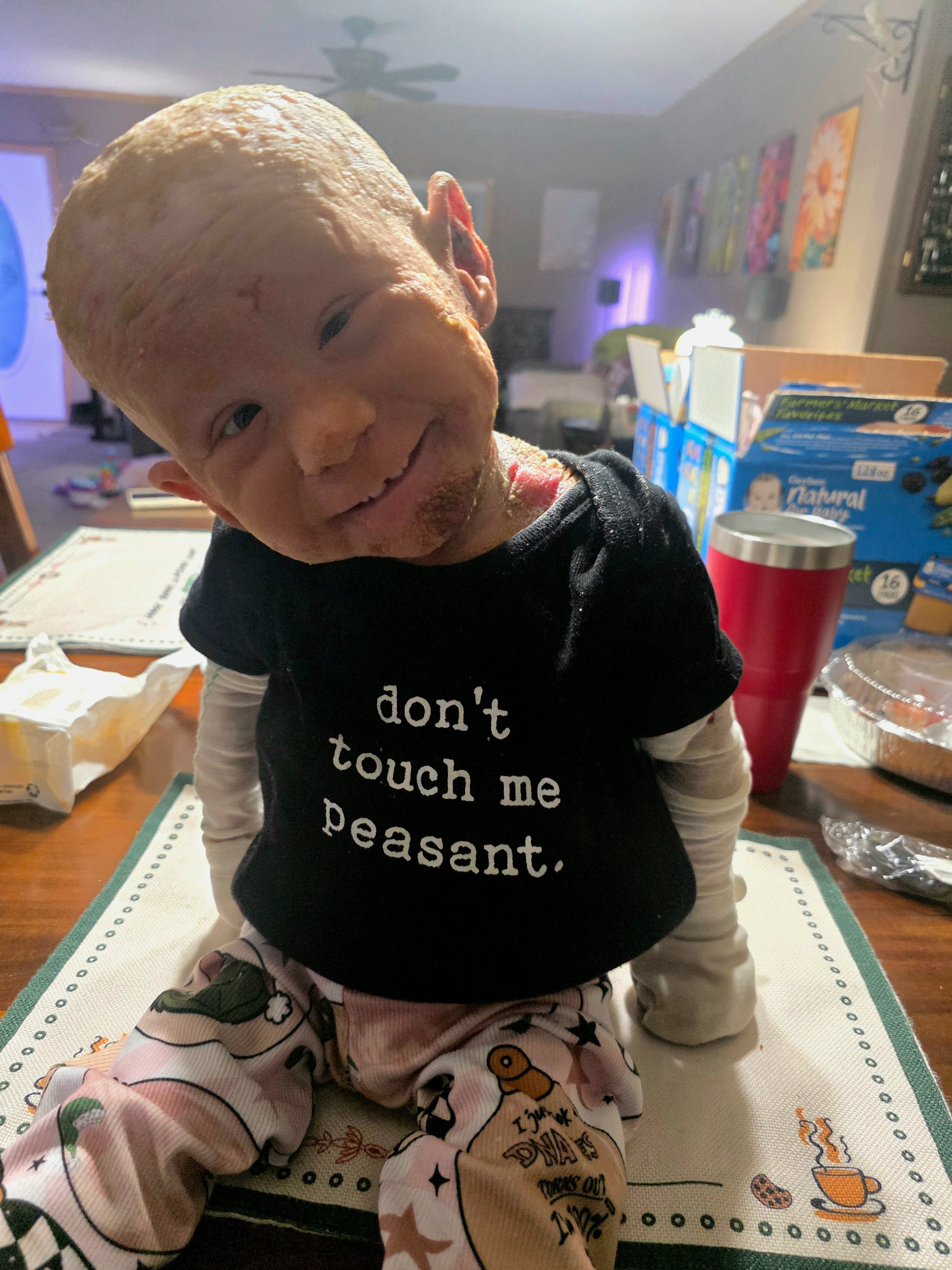 Help Scarlett Defy the Odds with KID Syndrome campaign photo, 4 of 8