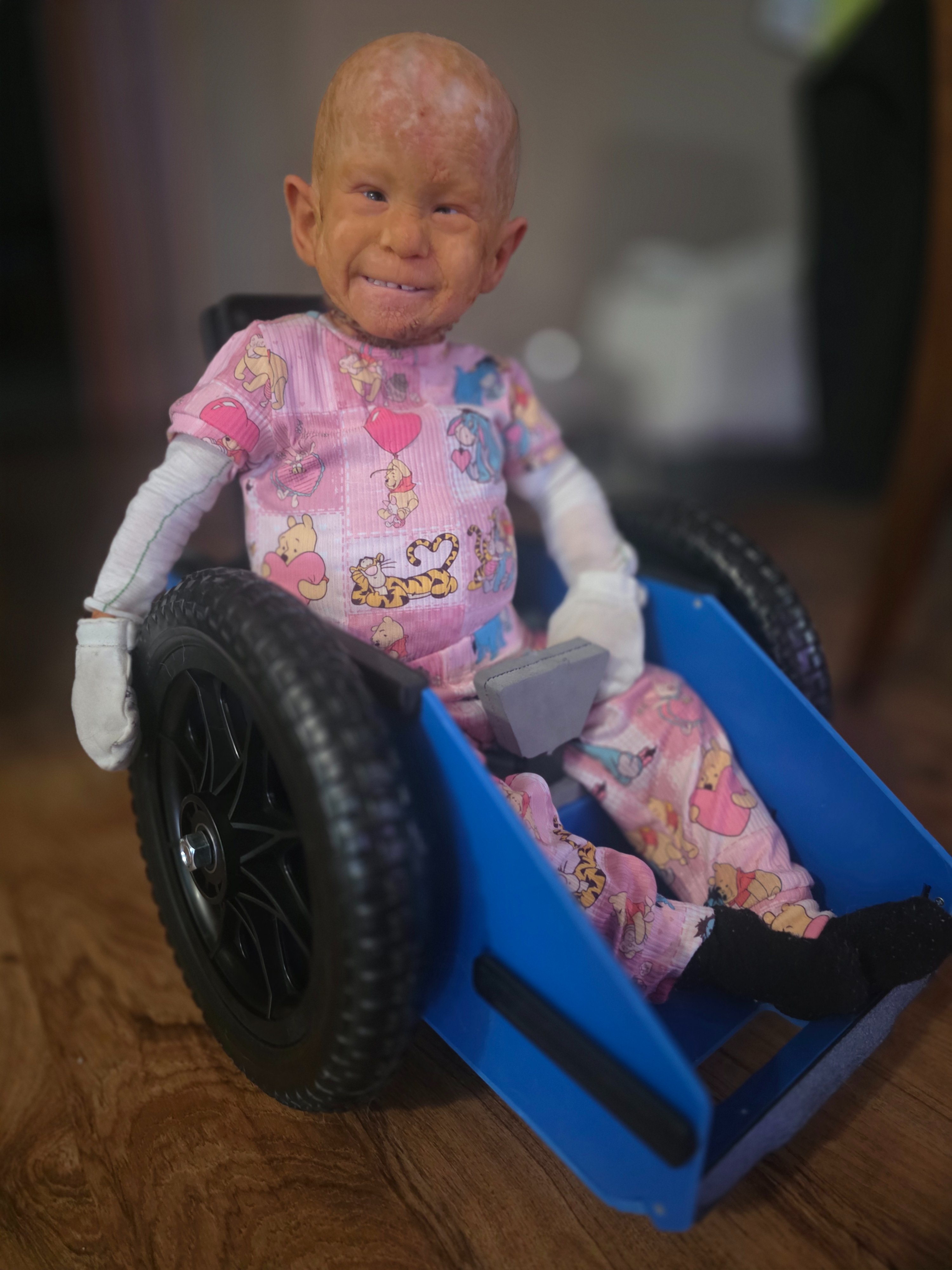 Help Scarlett Defy the Odds with KID Syndrome campaign photo, 5 of 8
