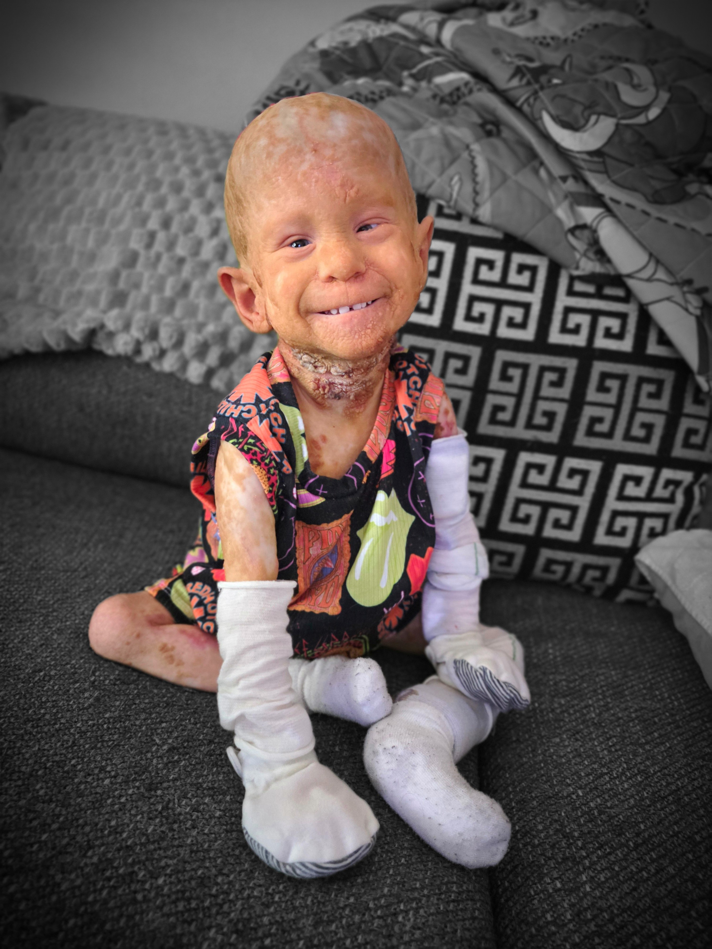 Help Scarlett Defy the Odds with KID Syndrome campaign photo, 6 of 8