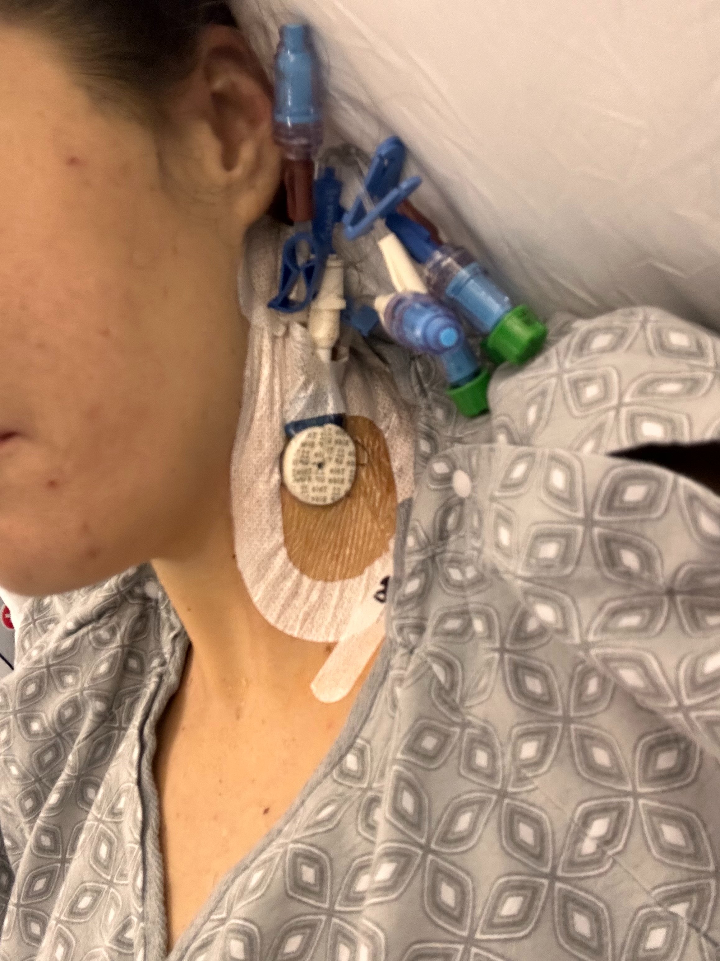Support Emily's Liver Transplant Recovery campaign photo, 2 of 7