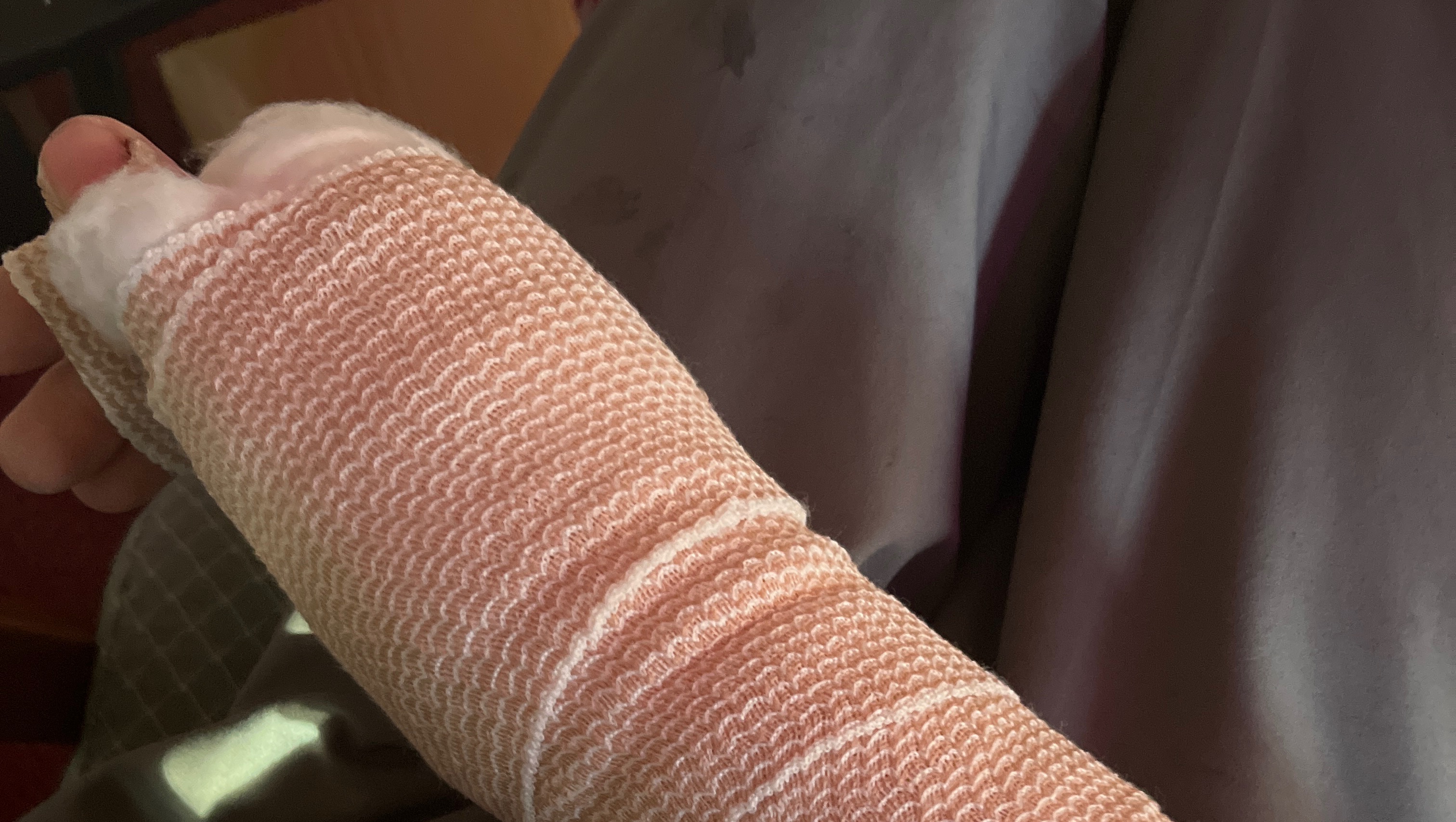 Help Kayden Recover from Hand Surgery photo