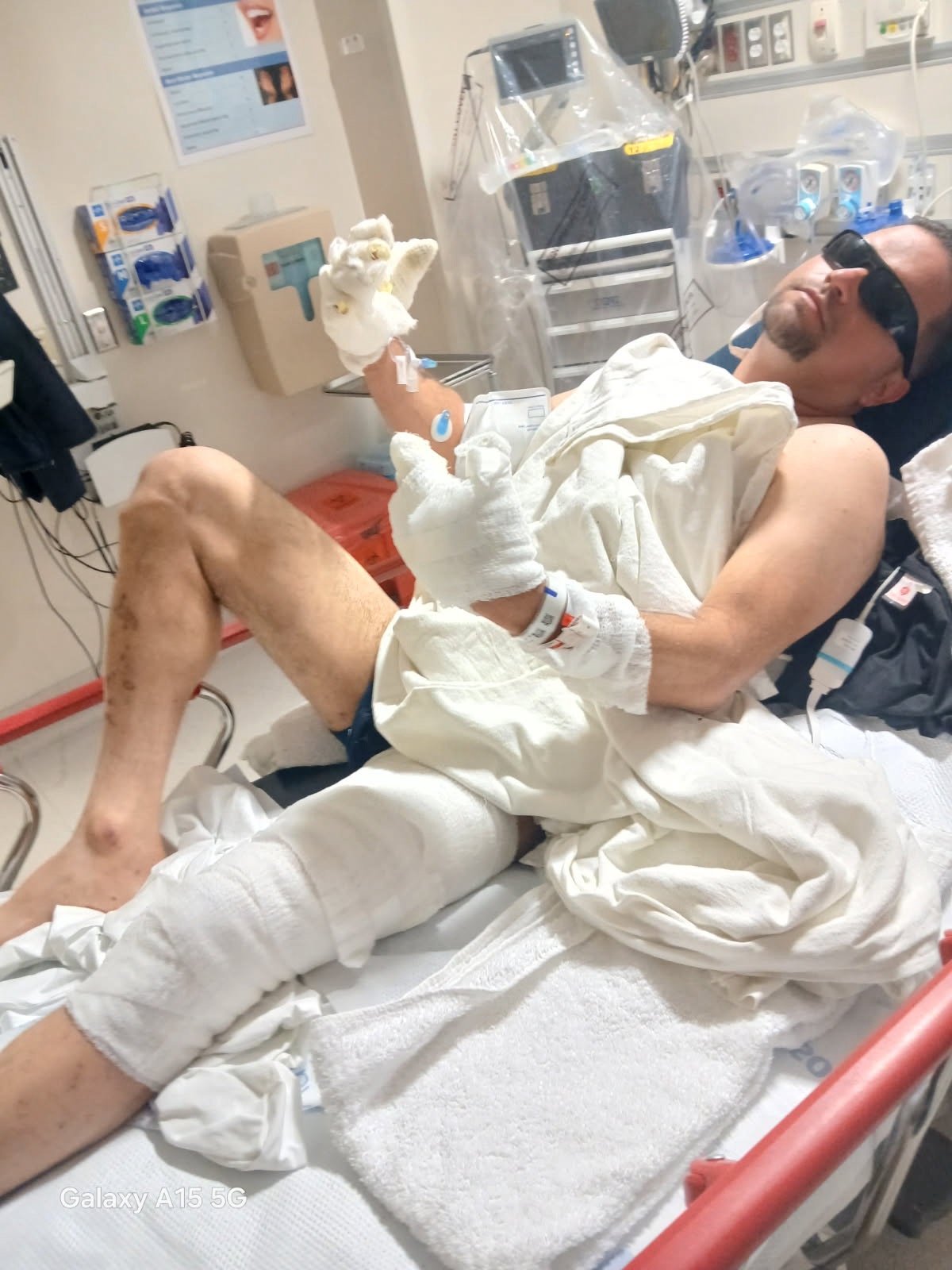 Help Victor Recover After a Portable Charger Explosion campaign photo, 2 of 5