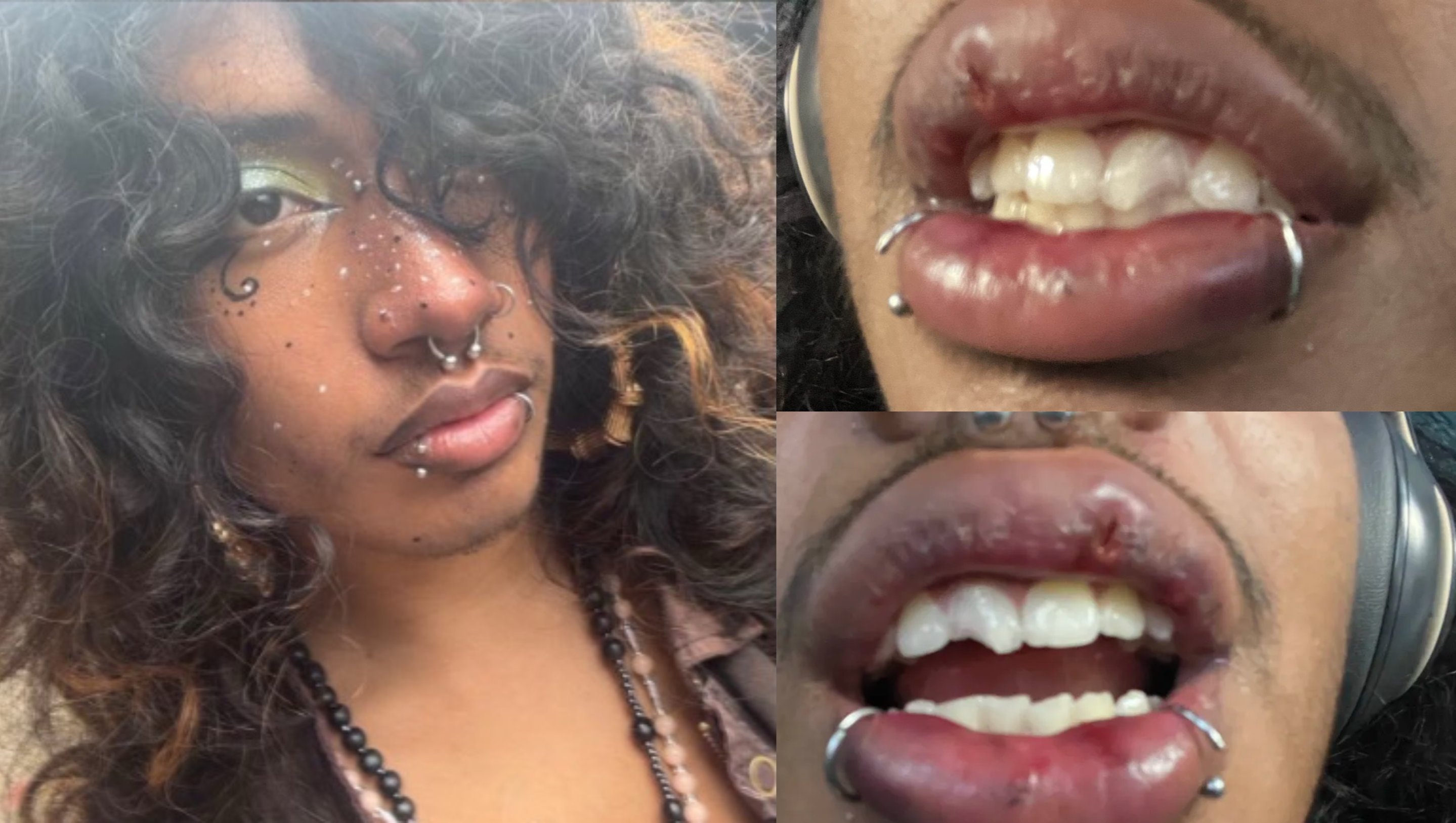 Support Trans Man's Recovery After Hate Crime