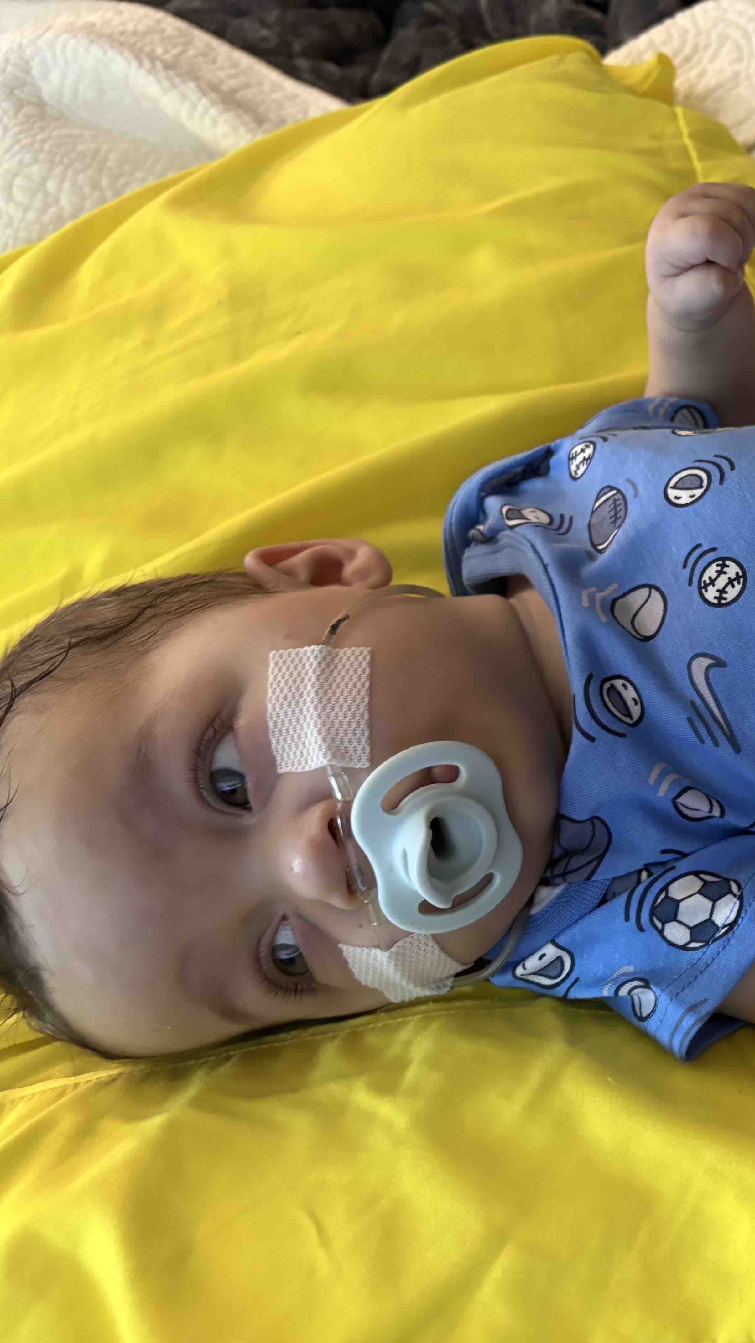Help baby Steven fight lifelong medical issues! photo