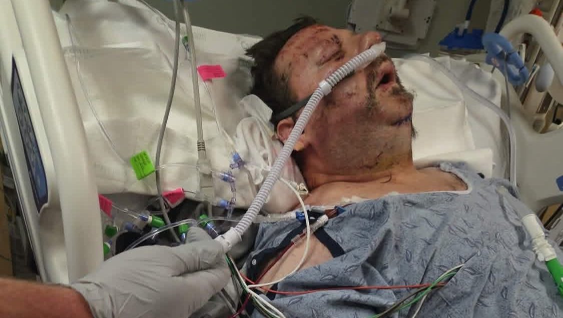 Help a Devoted Dad Recover from Severe Injuries photo