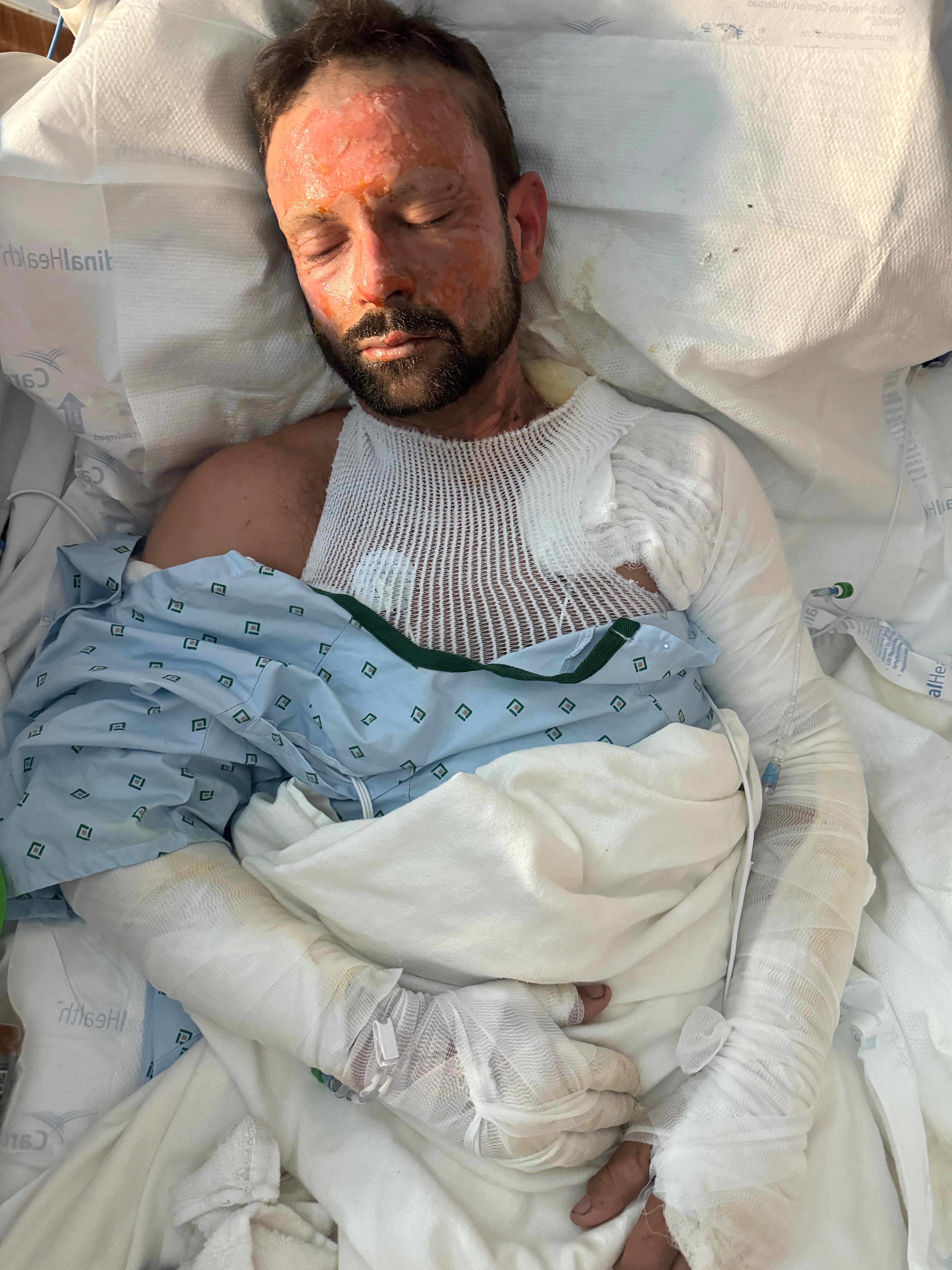 Help Justin Recover After A Devastating Boat Explosion campaign photo, 5 of 8