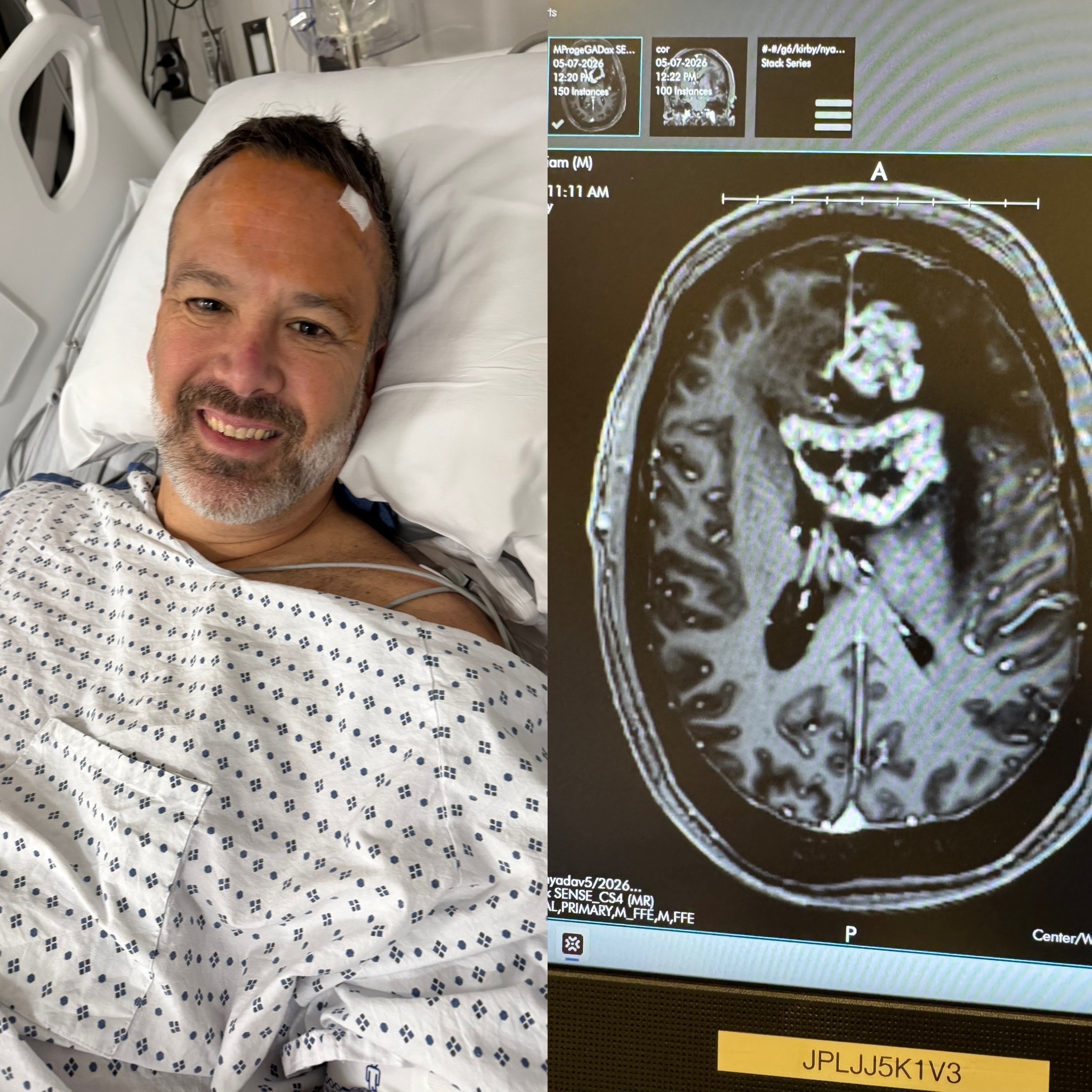 Backing Billy Magro’s Battle - Glioblastoma Brain Cancer campaign photo, 4 of 8