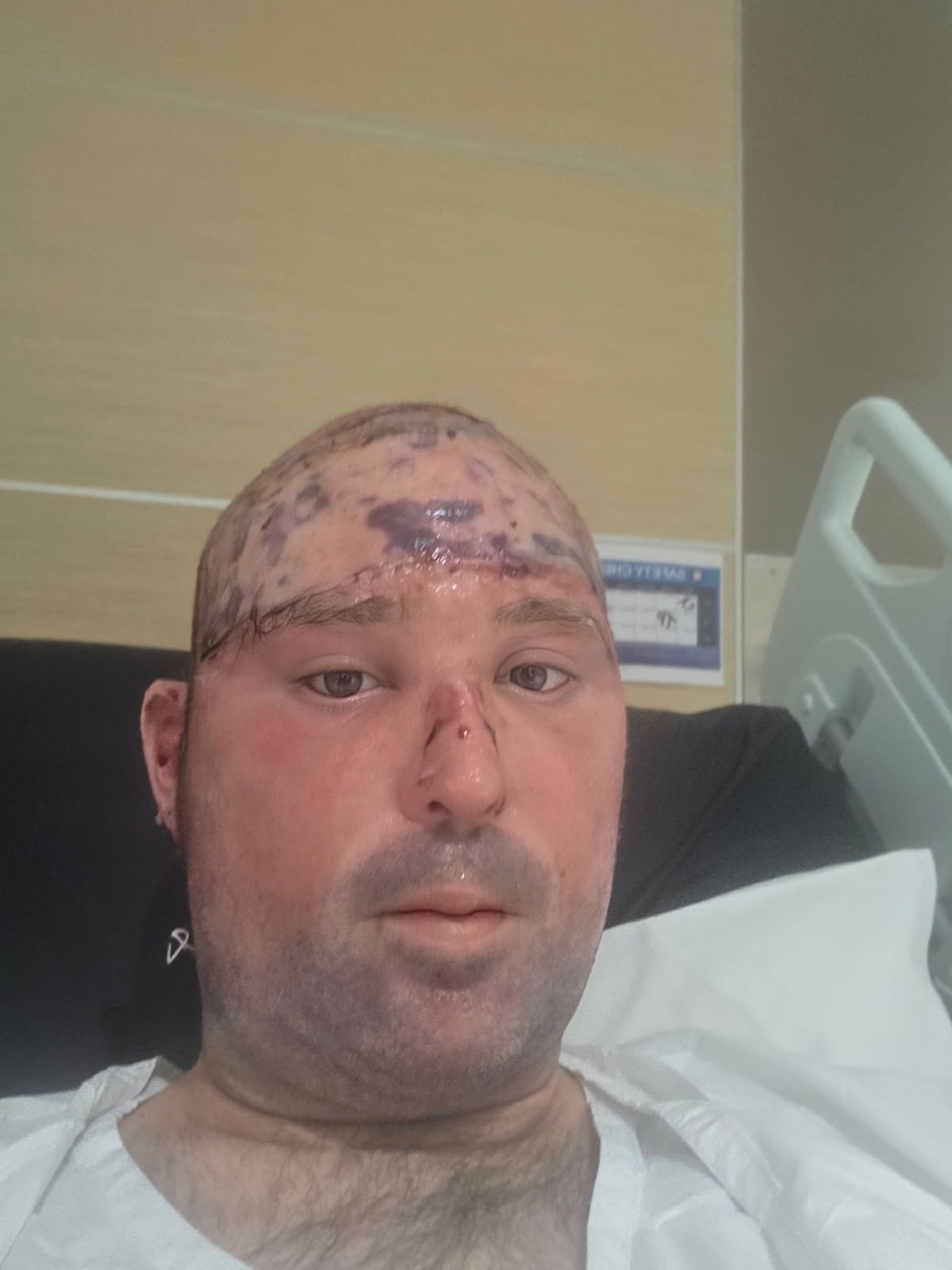 Support Dennis with his ongoing needs and future care . campaign photo, 5 of 8