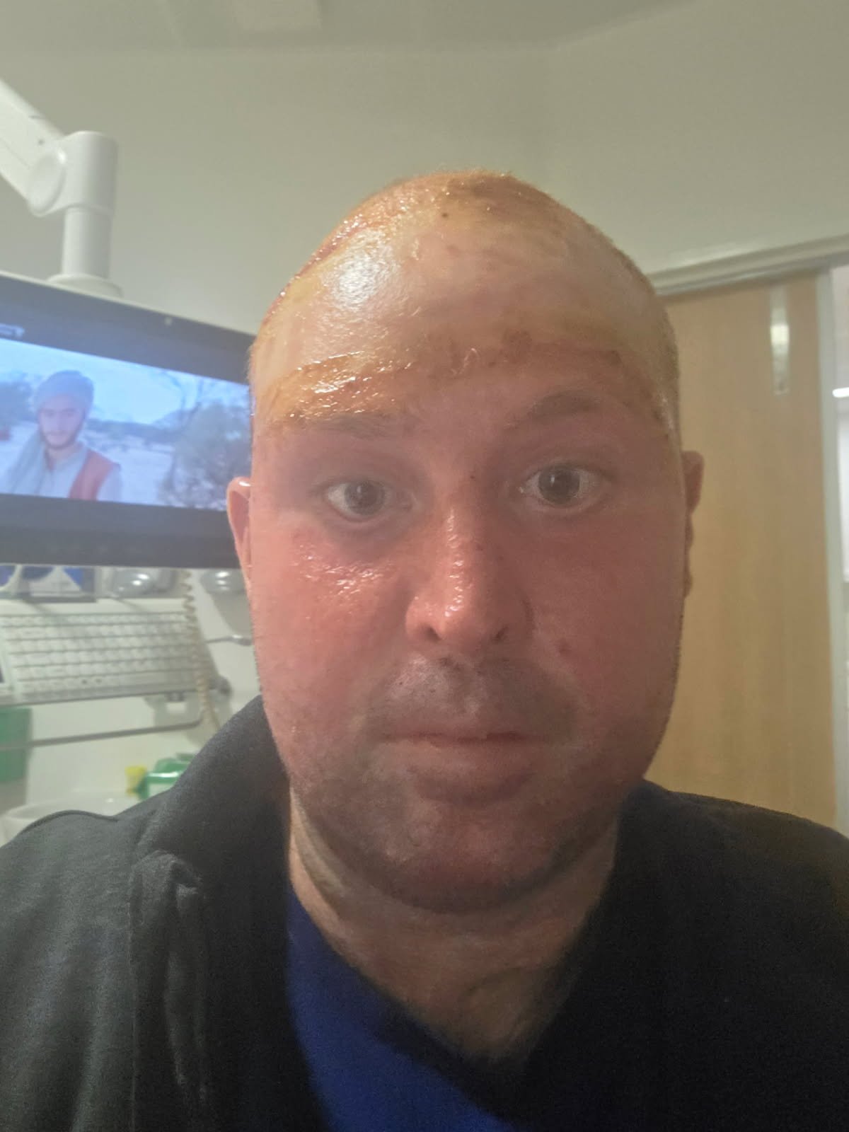Support Dennis with his ongoing needs and future care . campaign photo, 6 of 8