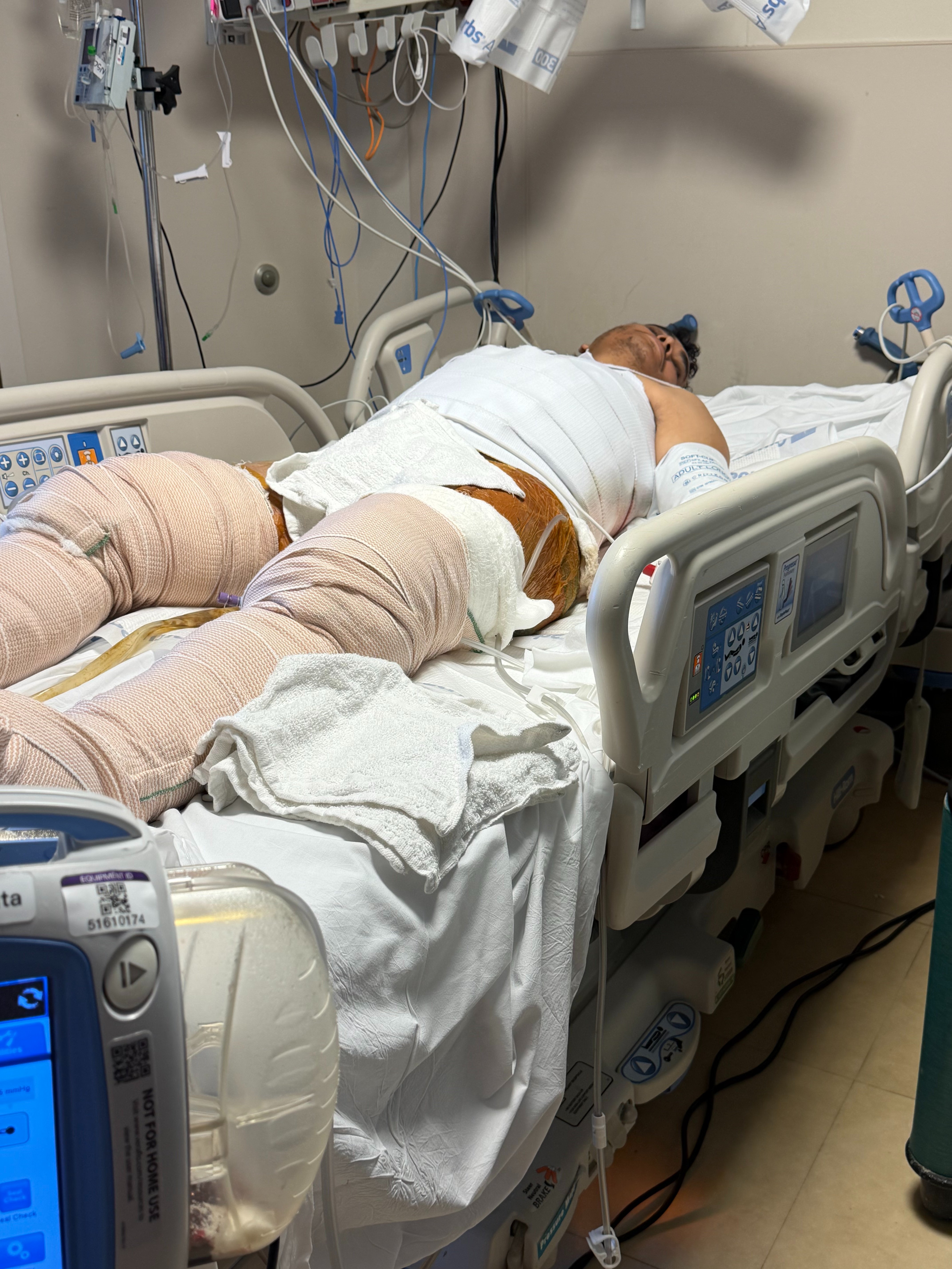 Support José’s Recovery from Severe Injuries campaign photo, 6 of 7