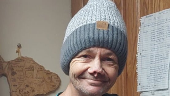 Help Ted Get Reconstructive Surgery photo