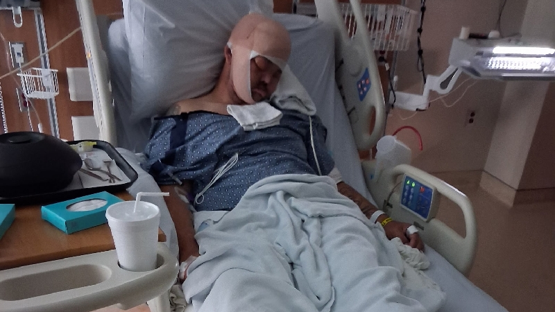 Support Larry's facial reconstruction Recovery After Acciden photo