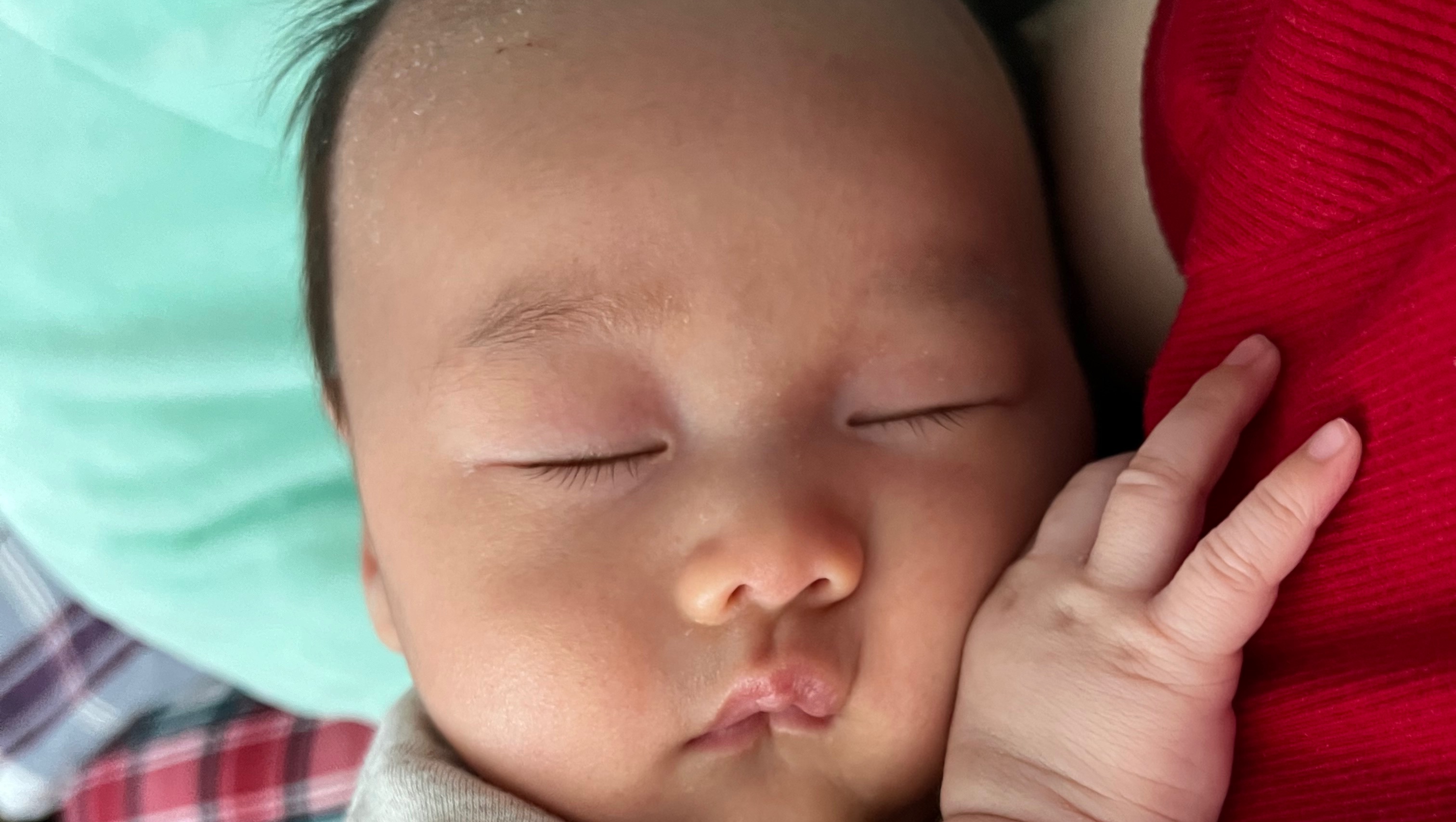 Help Baby Harry get a cranial remodeling helmet photo
