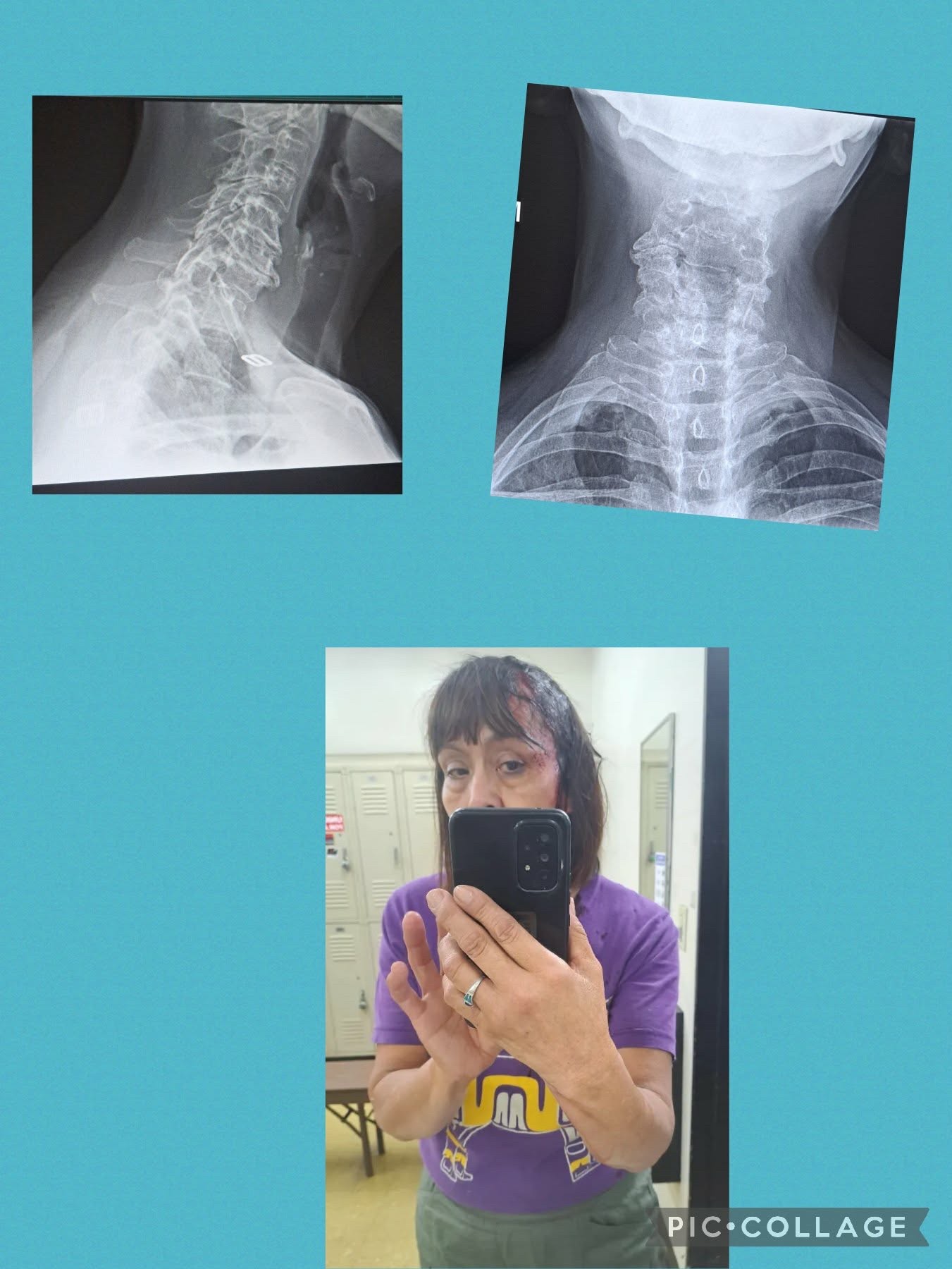 Support Deb’s Healing After Workplace Injury campaign photo, 2 of 4