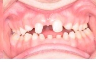 Help Gavin Smile & Breath Easier campaign photo, 5 of 7