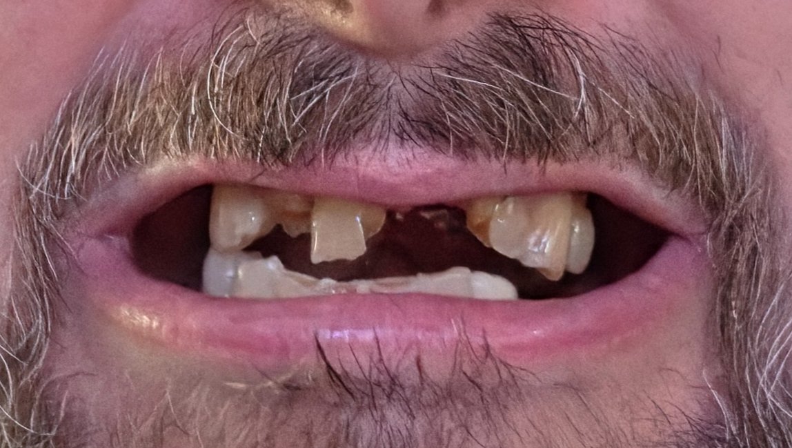 Help Bradley Get Dental Care & Dentures photo