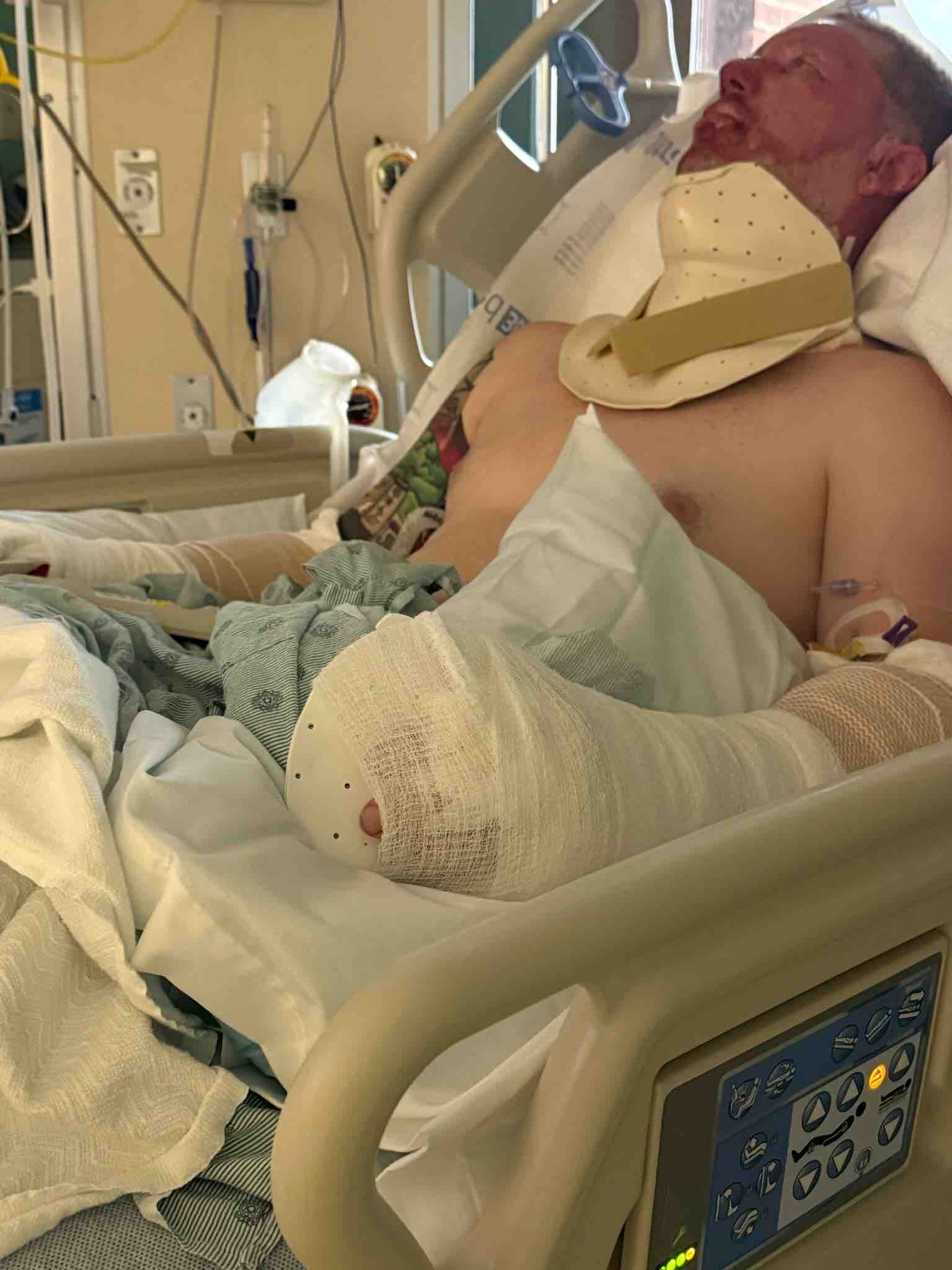 Help Bruce & Family after Electrical Explosion campaign photo, 8 of 11