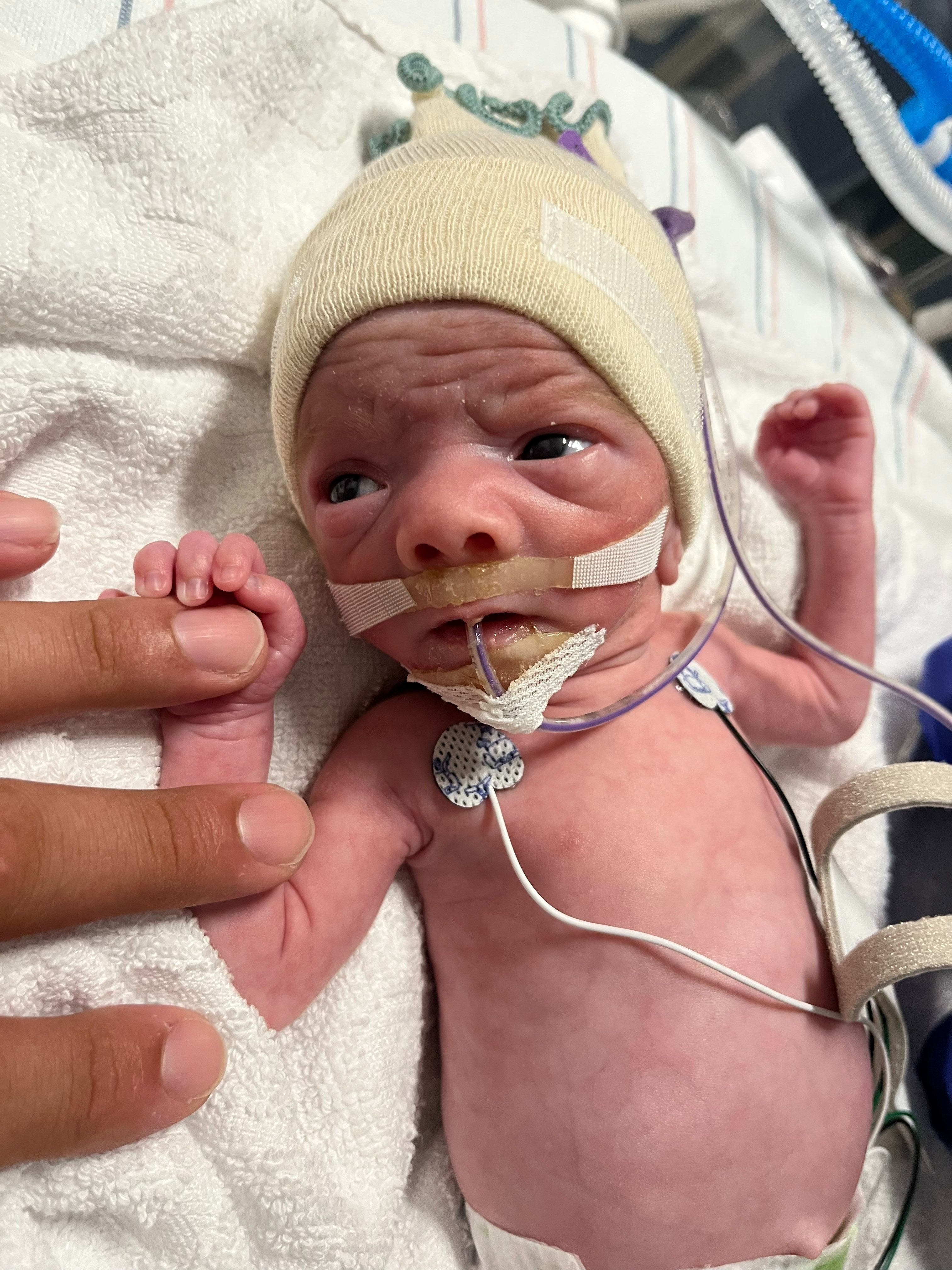 Help the Martinez Twins in the NICU campaign photo, 4 of 8