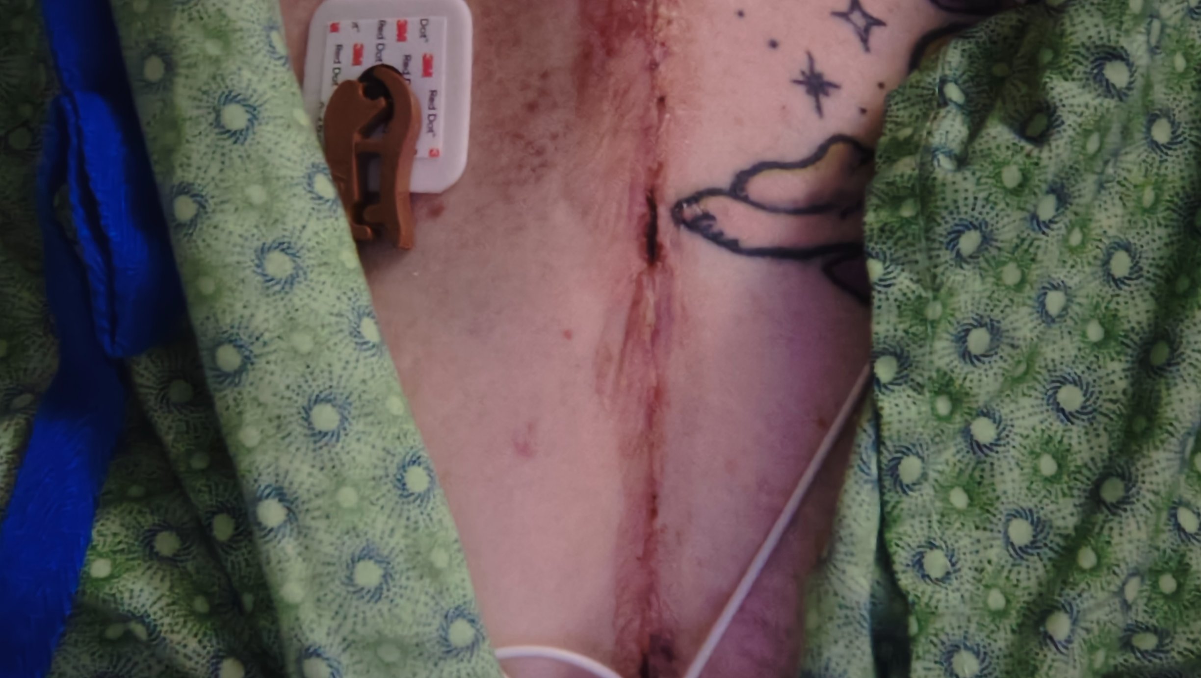Help Amanda Recover, Rebuild, and Reunite with Her Daughters photo