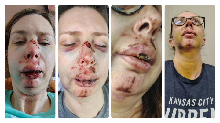Support Deena Gage & Family Through an Unimaginable Journey campaign photo, 4 of 5